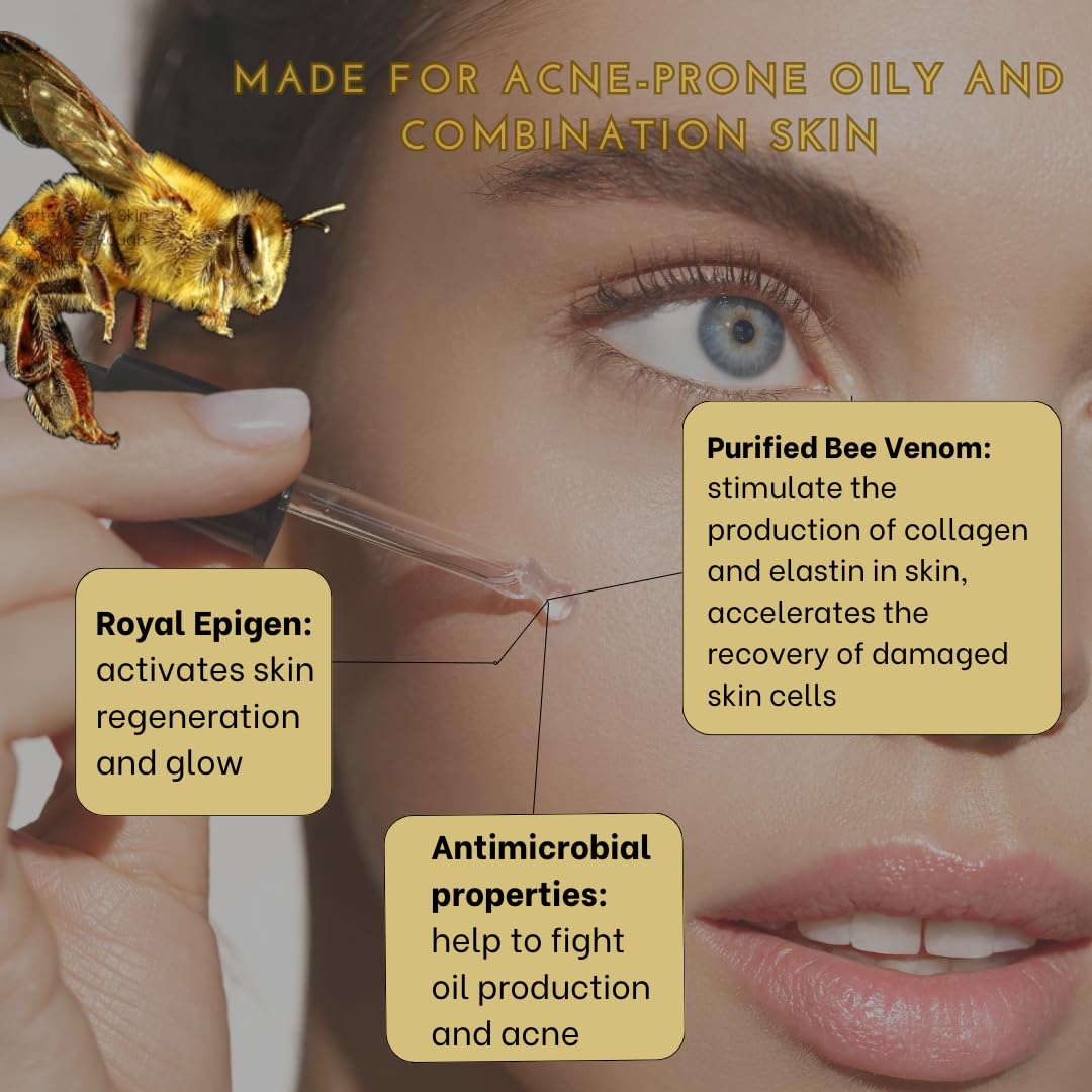 Bee Venom Serum for Anti-Aging & Acne Treatment - Breakout Prevention with Niacinamide, Vitamin C+E, Hyadisine & Royal Epigen P5 | Brightening Face Serum for Daily Skincare Routine
