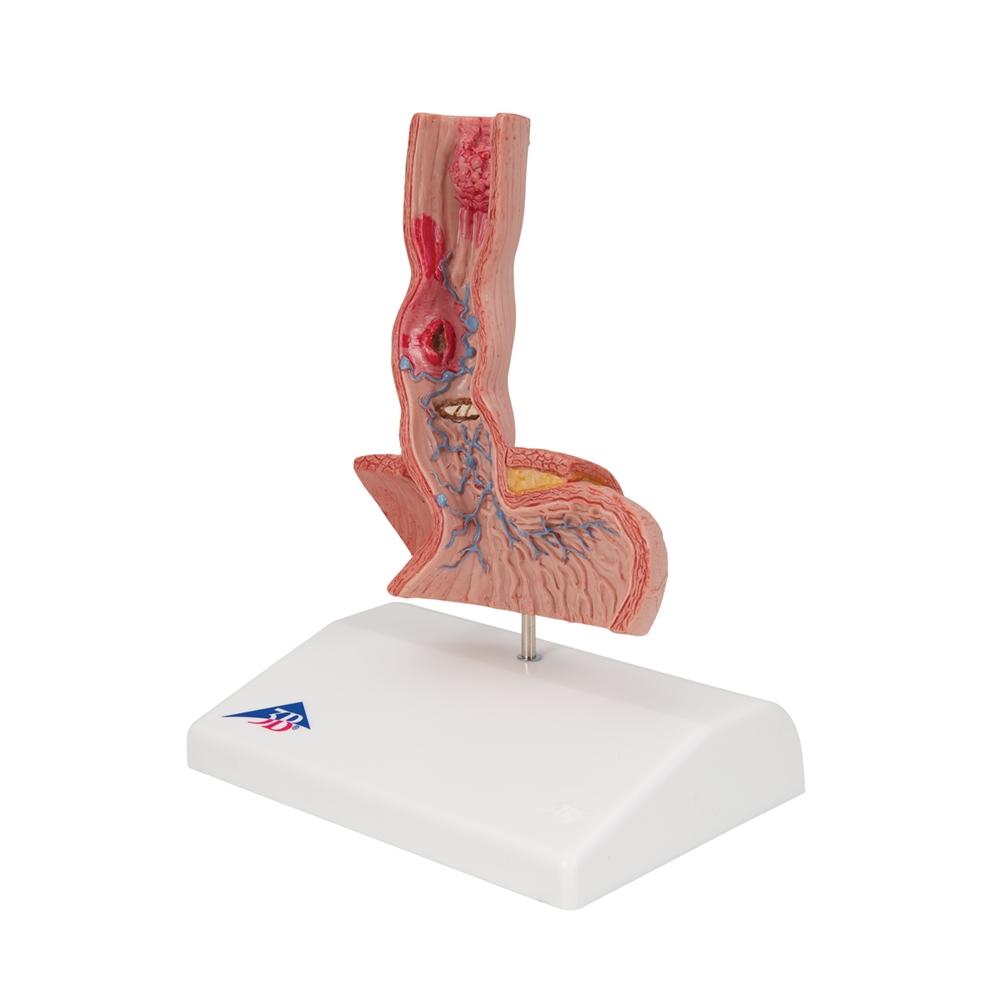 Human Esophagus Anatomy Model - Detailed Medical Teaching Tool for Digestive System Study | Ideal for Students, Doctors & Healthcare Professionals