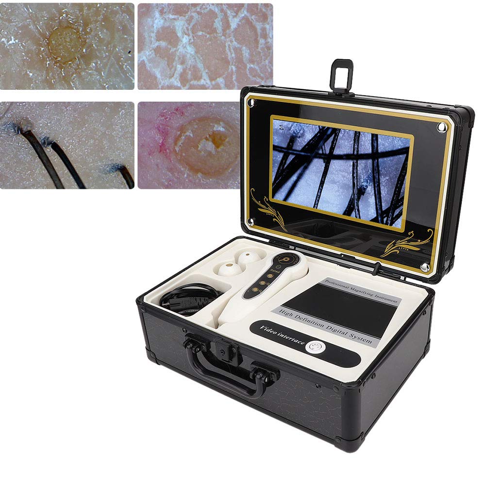 50X 200X Hair and Scalp Analyzer Machine with LCD Screen - Professional Skin Oil Detector & Microscope for Hair Care - Perfect for Salon Treatments and Home Scalp Health Analysis (US)