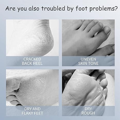 ADBHUTANAND Natural Foot Peeling Mask - Exfoliating Treatment for Dry Skin, Callus & Cracked Heels | Dead Skin Removal | Baby Soft Smooth Feet | 1 Count | Perfect for Pedicures & At-Home Foot Care