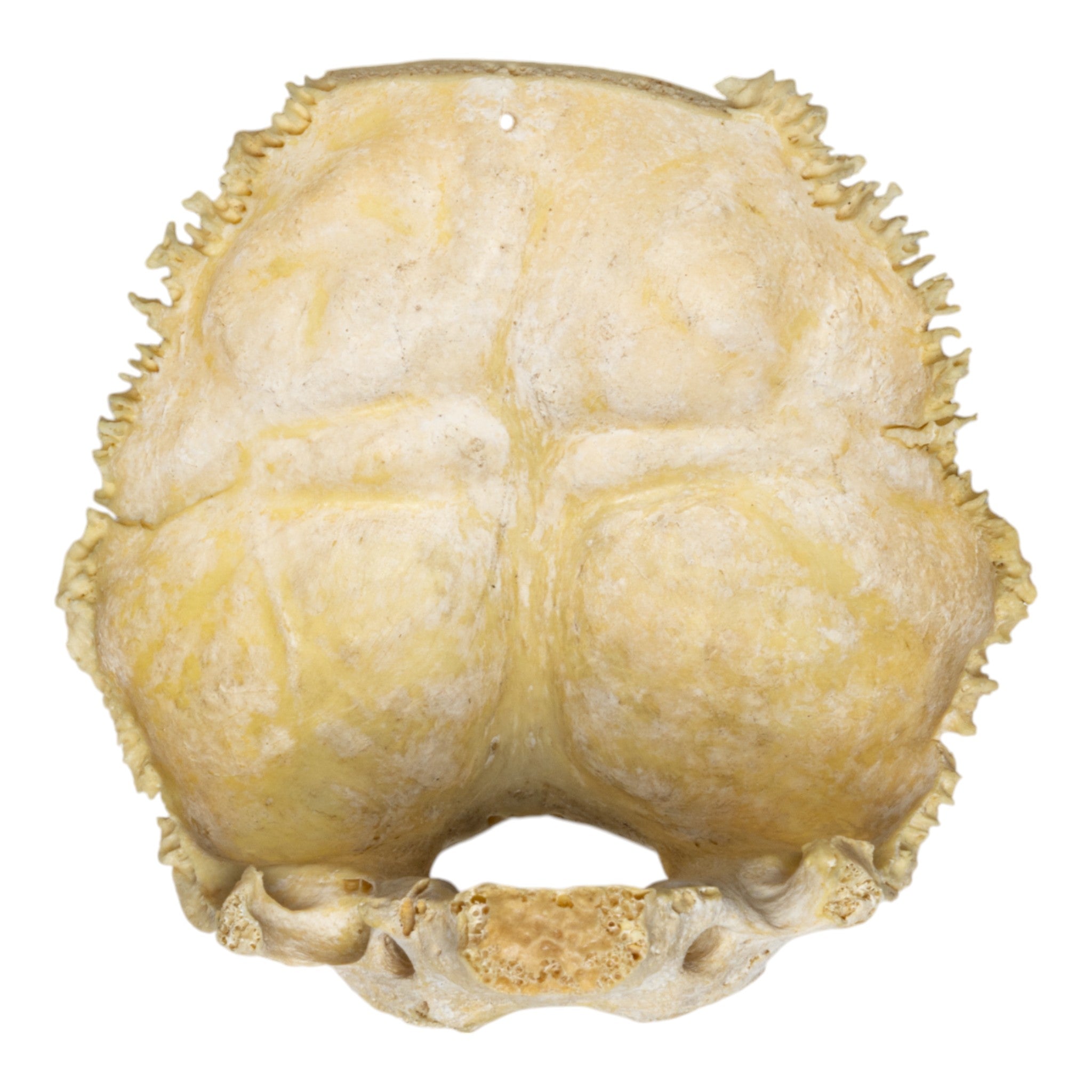 Authentic Human Child Occipital Bone Specimen - Medical Education, Anatomy Study & Forensic Science Training