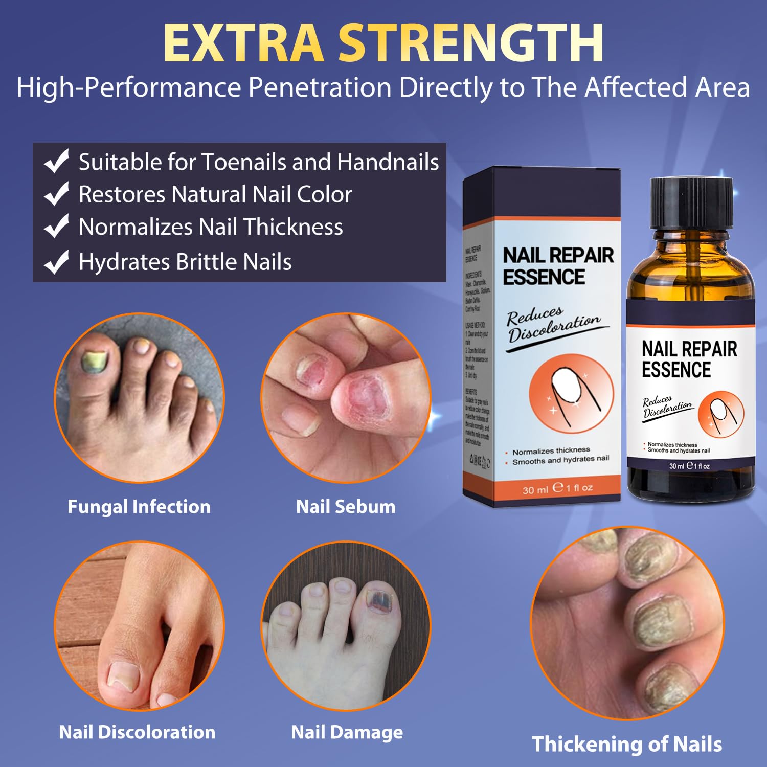 Extra Strength Toenail Fungus Treatment - Natural & Safe Repair for Damaged & Discolored Nails (30ml) | Effective Solution for Athlete's Foot & Nail Infections | Home Pedicure Care