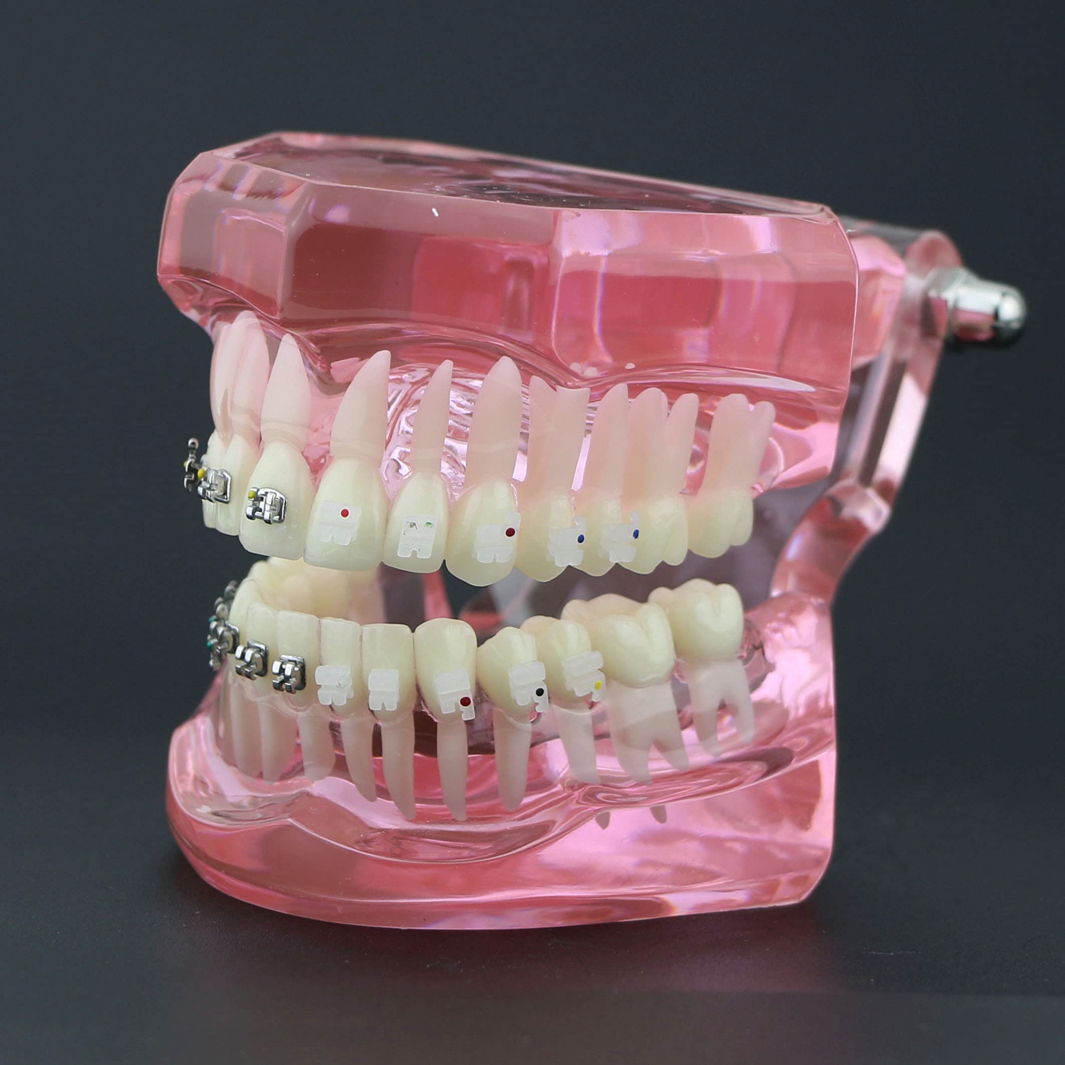 Dental Orthodontic Teeth Model with Metal & Ceramic Brackets - Professional Study Teeth Model for Dentists, Students & Orthodontic Training | Perfect for Dental Education, Practice & Office Display