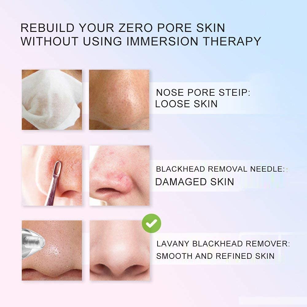 Tendula Professional Acne Pore Cleaner & Blackhead Remover Vacuum Kit - Facial Skin Care Tool for Pimple & Blemish Removal | Perfect for Daily Skincare Routine & Spa Treatments