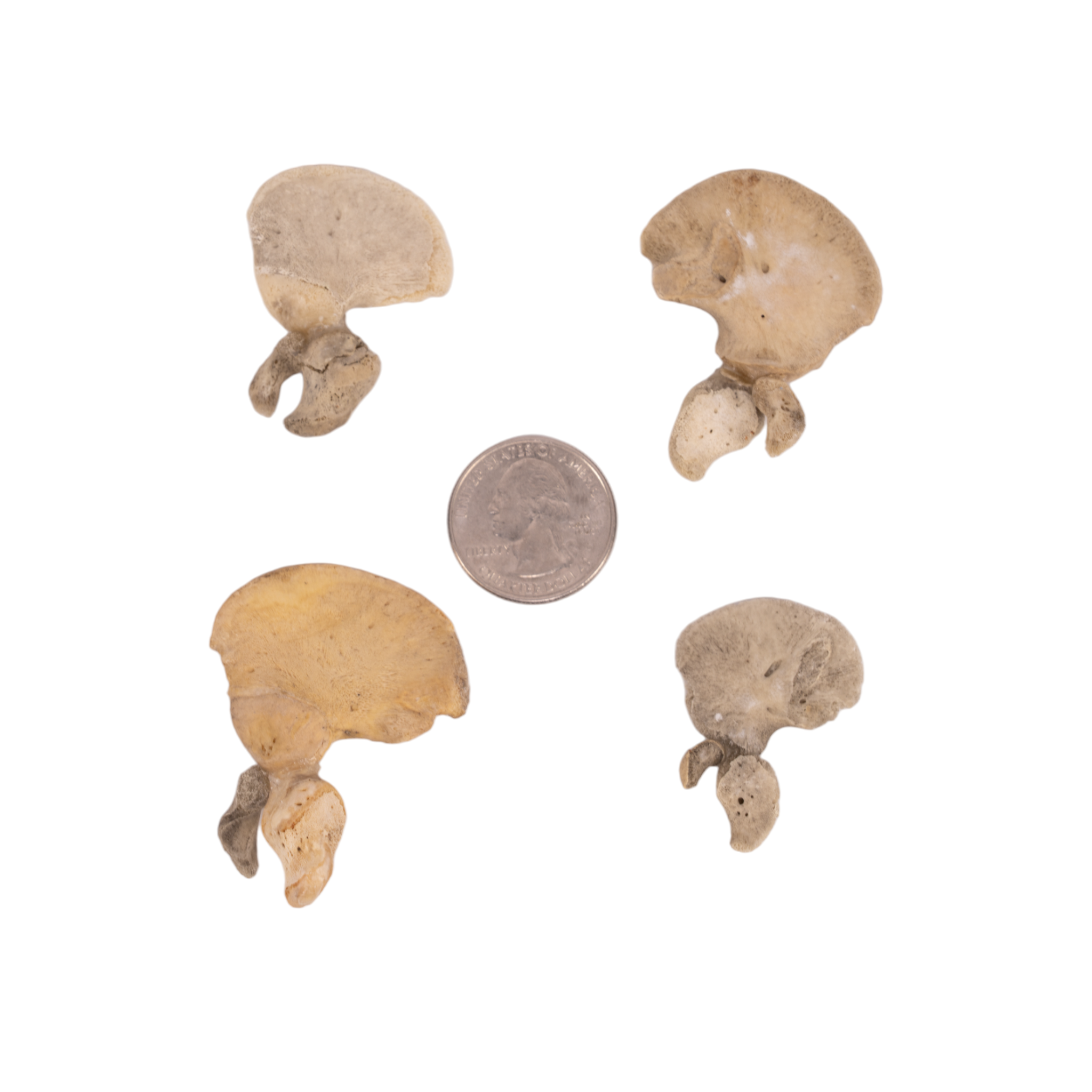 Premium Human Fetal Ilium for Medical Research - High-Quality Anatomical Specimen for Pathology Studies, Medical Education & Scientific Research