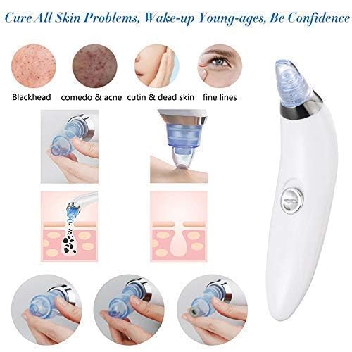BEAMBOX 4-in-1 Blackhead Remover Vacuum Kit - Professional Pore Cleaner & Acne Treatment for Men & Women - Skin Care Tool for Blackhead Removal, Pimple Extraction & Facial Cleansing - Perfect for Home Spa & Daily Skincare Routine