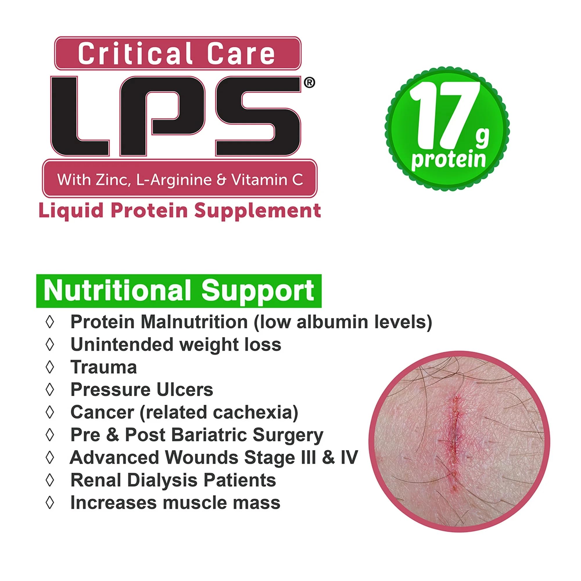 Nutritional Designs LPS Liquid Collagen & Whey Protein Supplement - Sugar-Free, Non-GMO Drink for Healthy Skin & Hair - Supports Joint Health - Cherry Flavor (Critical Care) - Perfect for Post-Workout Recovery & Daily Beauty Routine