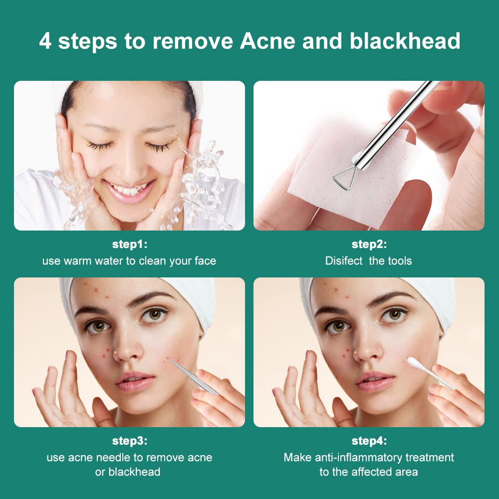 Professional Blackhead Remover & Pimple Popper Tool Kit - 6-Piece Stainless Steel Acne Comedone Extractor for Blackheads, Whiteheads & Blemishes - Safe & Effective Skin Care Tools for Facial Treatment & Spa Use