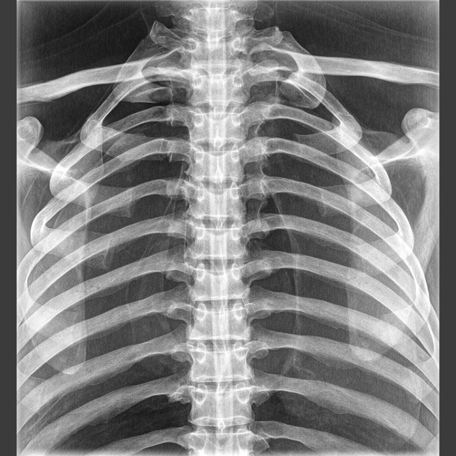 Full Body X-Ray Phantom with Real Human Skeleton Bones - High-Quality Medical Training Model for Radiology, Anatomy Studies & X-Ray Positioning Practice (Ideal for Medical Schools, Hospitals & Research Labs)
