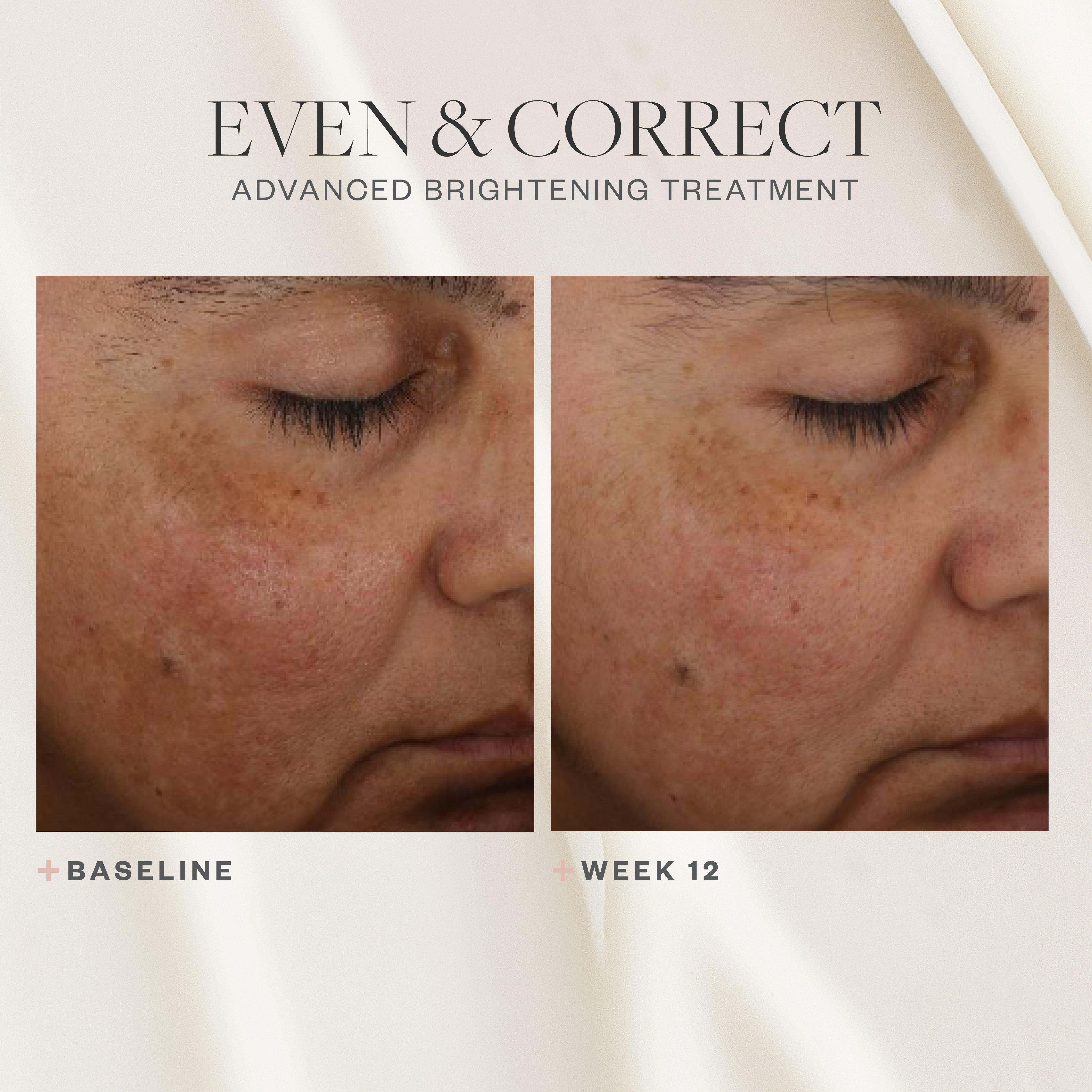 Even & Correct Advanced Brightening Treatment - Skin Brightening Cream for Dark Spots & Hyperpigmentation - Perfect for Nighttime Skincare Routine & Uneven Skin Tone Correction