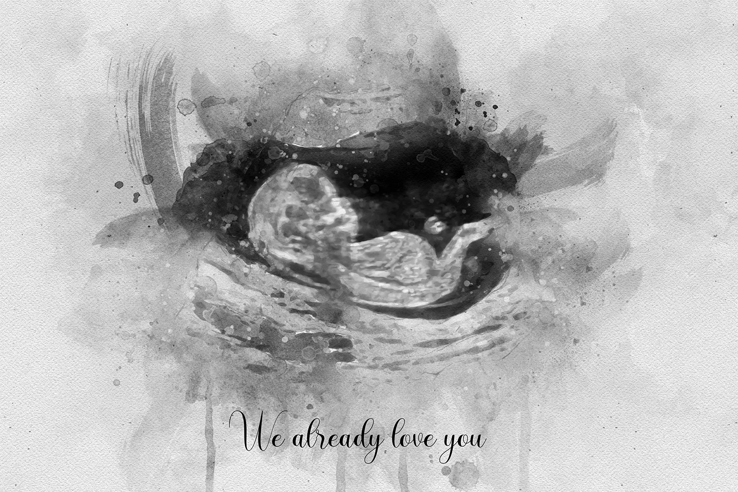 Personalized Gender Reveal Ultrasound Watercolor Portrait - Custom Baby Sonogram Art from Photo - Unique Pregnancy Announcement Gift for Baby Showers, Nurseries & Gender Reveal Parties