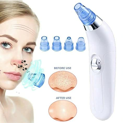 Diazola Blackhead Remover & Pore Vacuum Cleaner - Professional Pimple Extractor Tool for Face & Nose | Skin Care Device for Women & Men | Perfect for Daily Facial Cleansing & Acne Treatment at Home