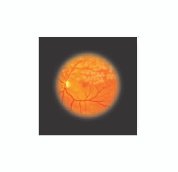 Professional EYE Examination Simulator II (2 Steps) - Perfect for Ophthalmology Training & Clinical Practice