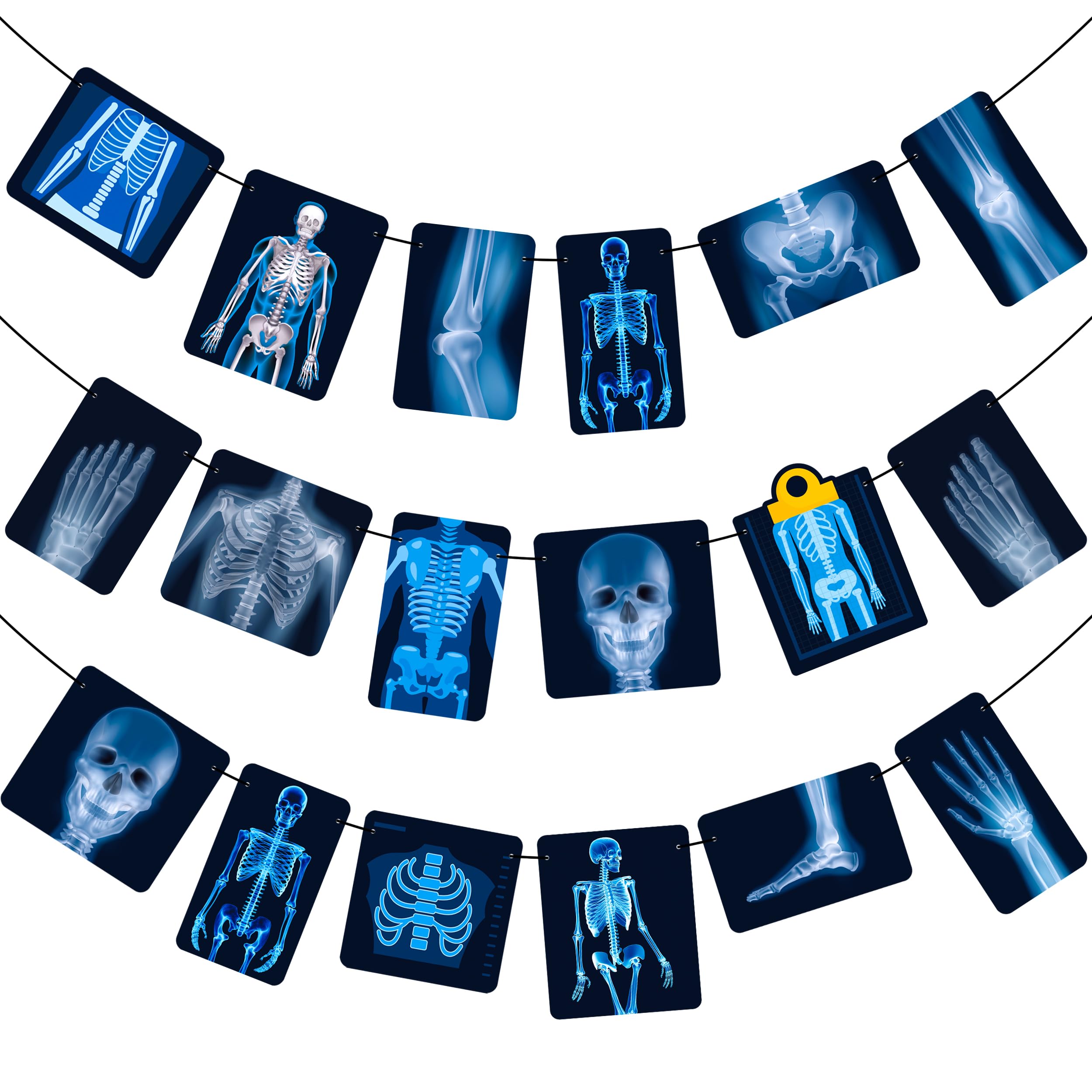 Radiology X-Ray Party Decorations - X-Ray Theme Banners & Garlands for Doctor Birthday, Medical Theme Party & Baby Shower Supplies | Perfect for Radiology Graduation, Healthcare Celebrations & Hospital-Themed Events