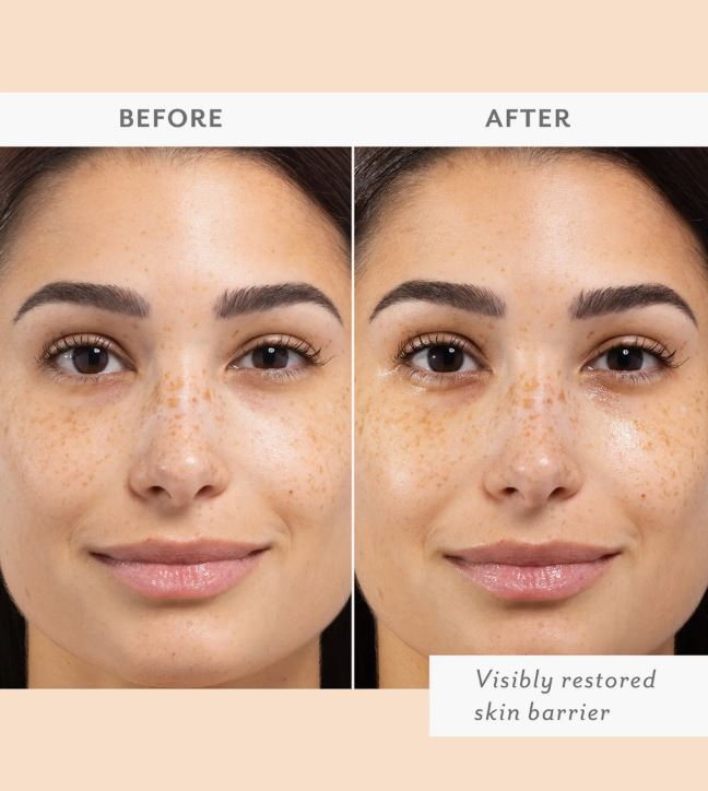 Patchology Skin Remedy Barrier Boosting Sheet Mask - Hydrating Facial Mask for Dry Skin - 1 Count - Perfect for Skincare Routine & Self-Care Days