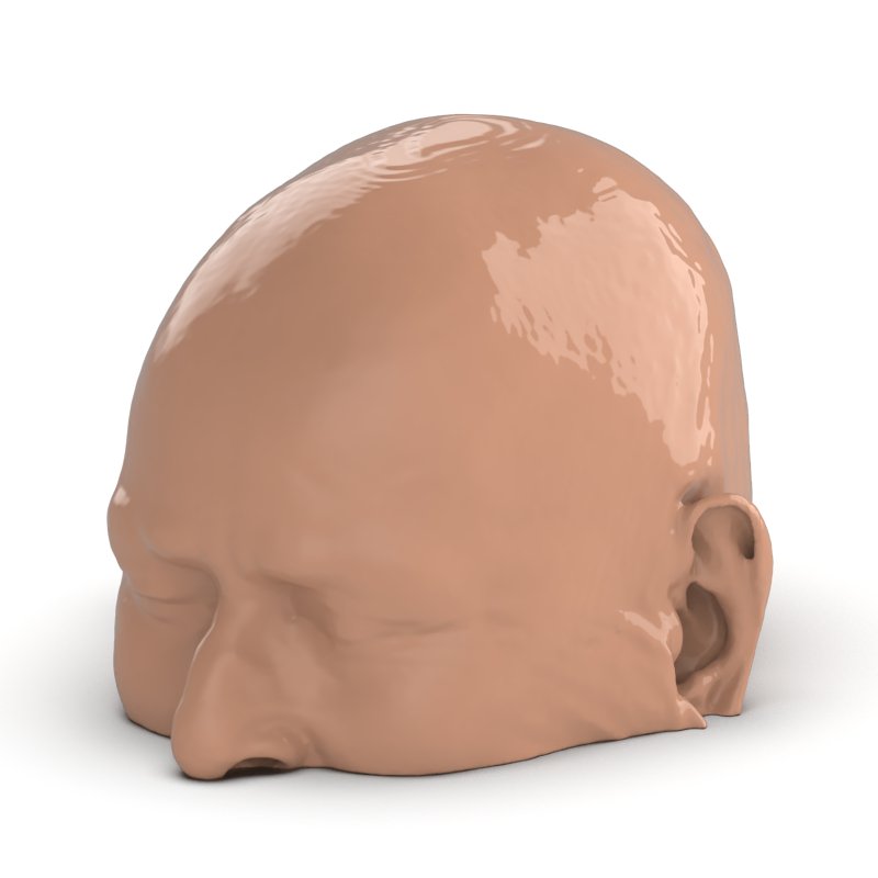 CTA Aneurysm Head Phantom for CT Scan and X-Ray Training - High-Quality Medical Simulation Tool for Radiology Education and Diagnostic Practice