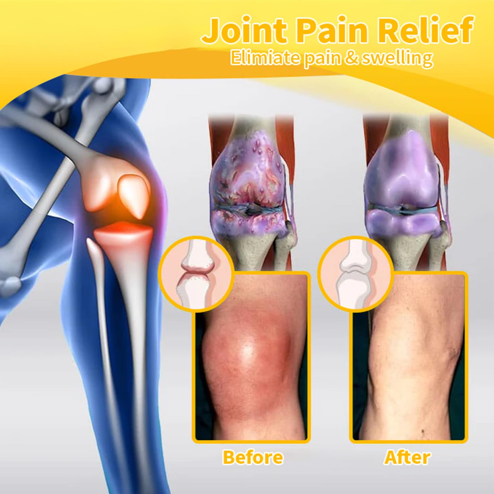 Professional Botulinum Toxin & Bee Venom Pain Relief Cream - Natural Joint & Bone Therapy Gel for Back, Neck, Hands & Knee Pain - Effective Muscle & Arthritis Relief - Ideal for Athletes, Office Workers & Seniors (1 Pack)