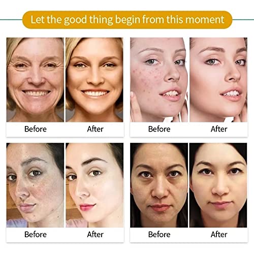 Organic Bentonite Clay & Turmeric Face Mask with Aloe Vera, Vitamins A, C & E - Brightening, Anti-Aging, Pore Minimizing & Blemish Treatment for Glowing Skin | Perfect for Daily Skincare & Spa Nights