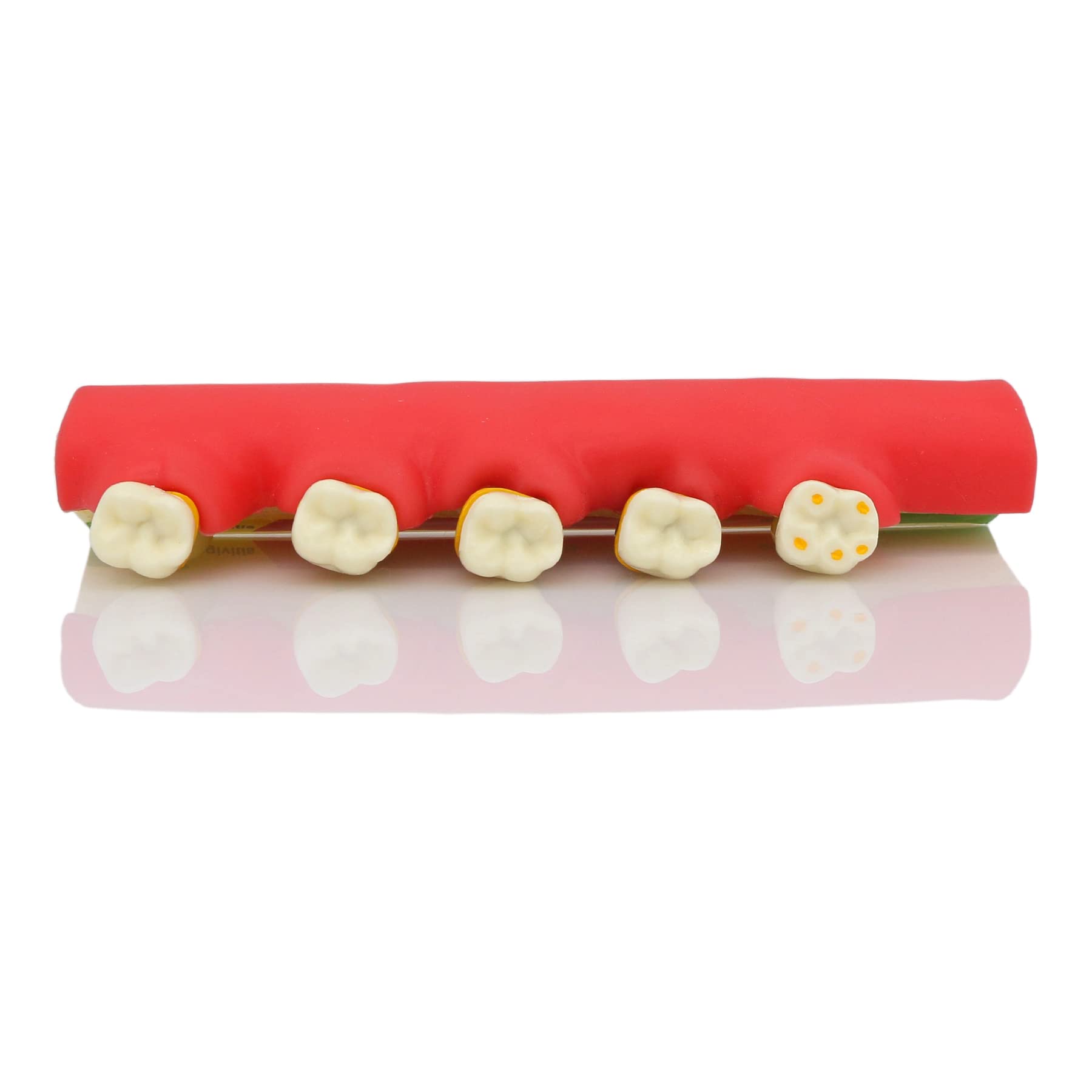 Dental Typodont Teeth Model for Adults & Children - Pathological Demonstration for Teaching & Studying (M4010) | Ideal for Dental Schools, Training & Clinical Practice