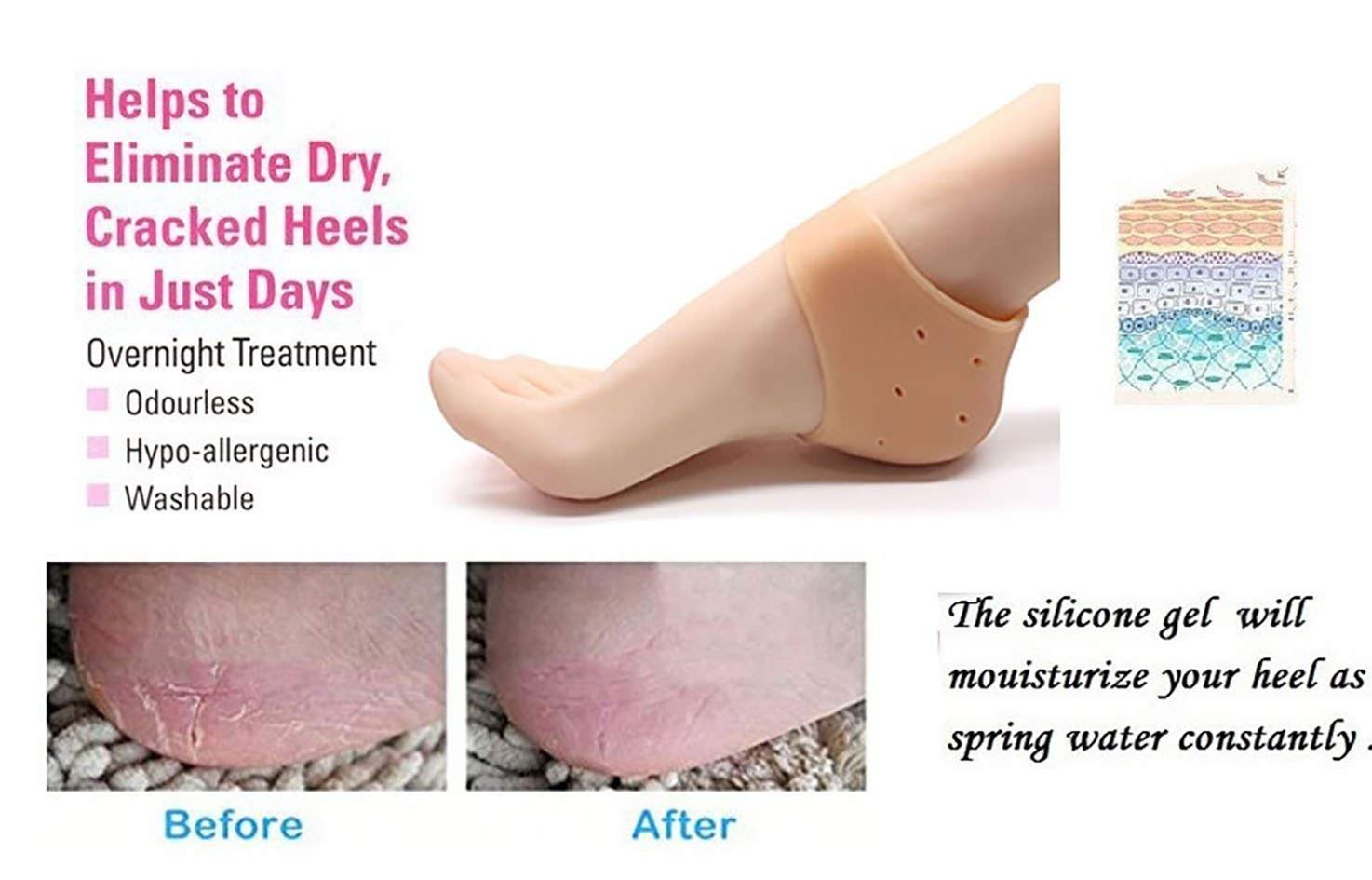 Acupressure Silicone Gel Heel Pad Socks for Pain Relief - Plantar Fasciitis & Heel Spur Support for Men & Women (Beige, One Size Fits All) - Perfect for Running, Walking & Daily Comfort