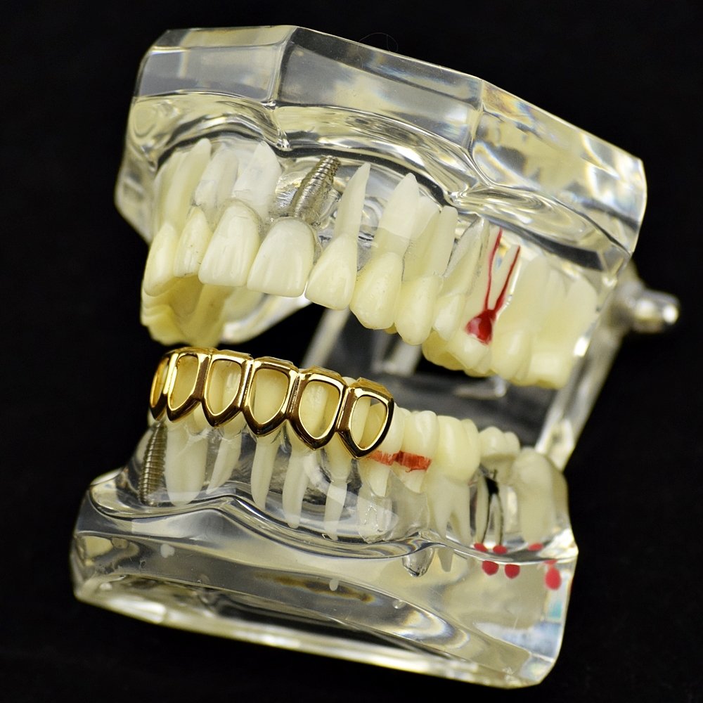 14K Gold Plated Open Face Grillz - 6 Tooth Lower Row Bottom Teeth for Hip Hop Style | Perfect for Rappers, Performers & Street Fashion (Men & Women)