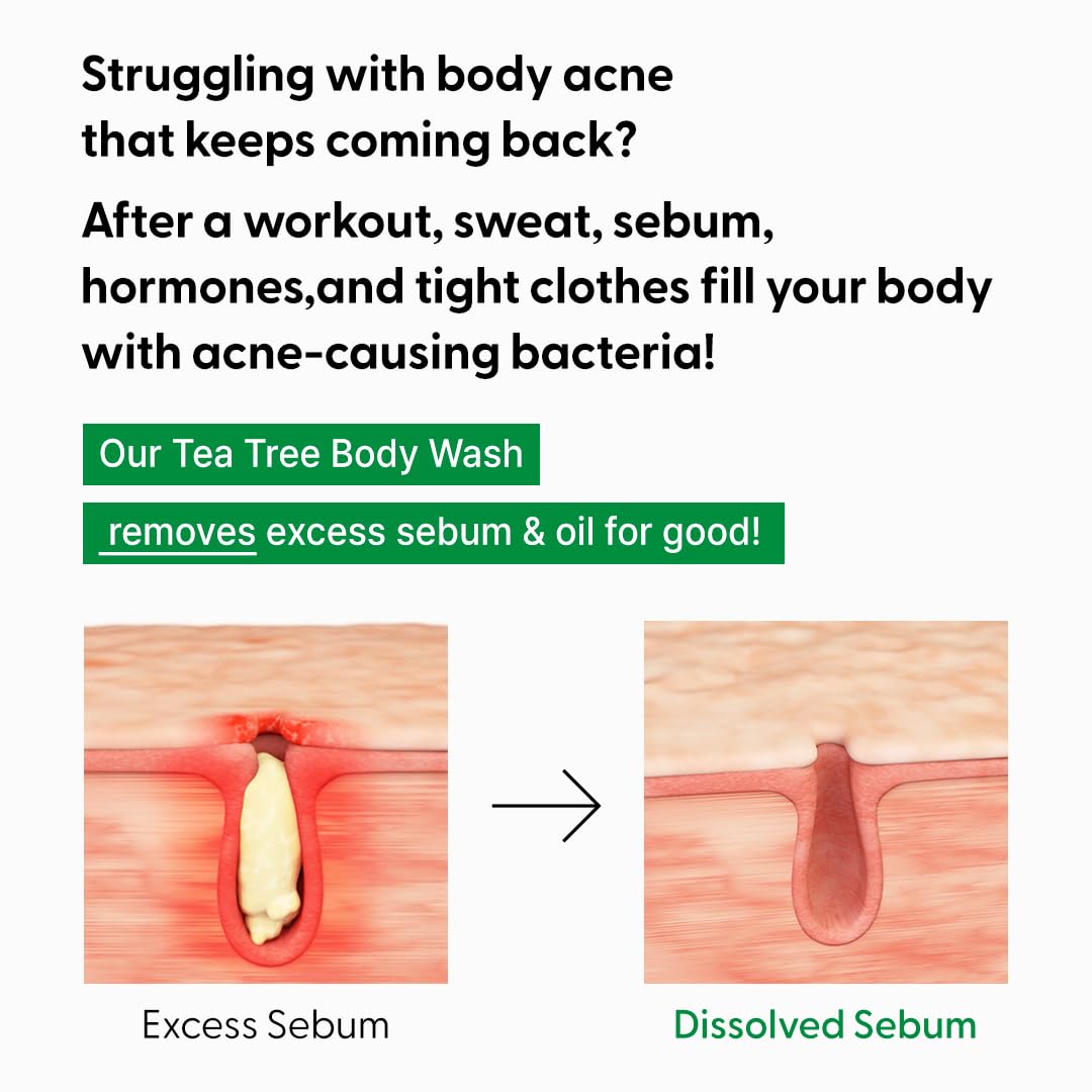 Green Tea & Tea Tree Body Wash for Acne-Prone Skin - Korean Skincare with Centella Asiatica & Heartleaf Extracts | Moisturizing, Hypoallergenic Cleanser for Sensitive Skin | 16.9 fl oz | Perfect for Daily Shower & Post-Workout Skincare Routine