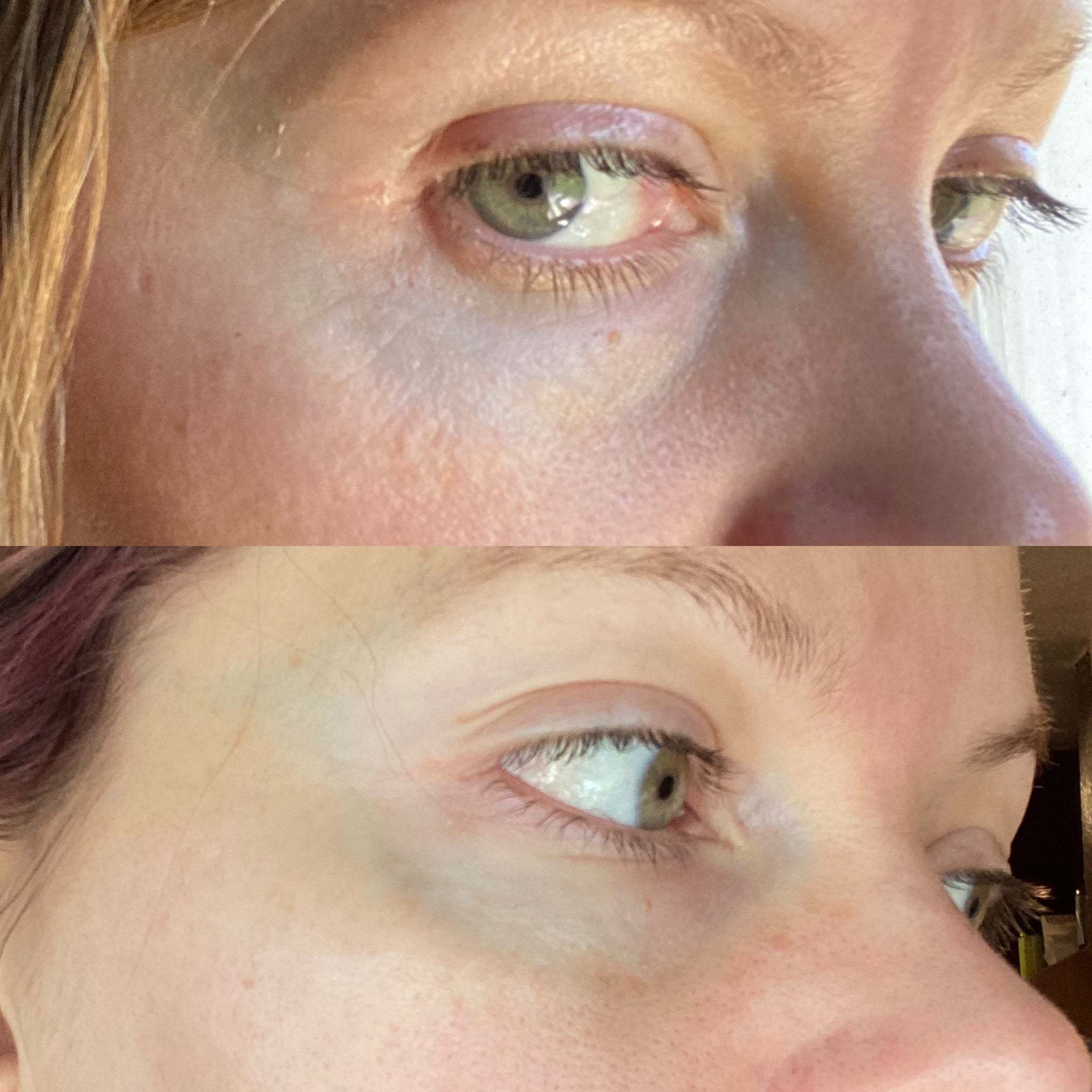 Deep Repair Eye Serum for Dark Circles & Wrinkles - Anti-Aging Eye Treatment with Hyaluronic Acid & Vitamin C - Perfect for Night & Day Use