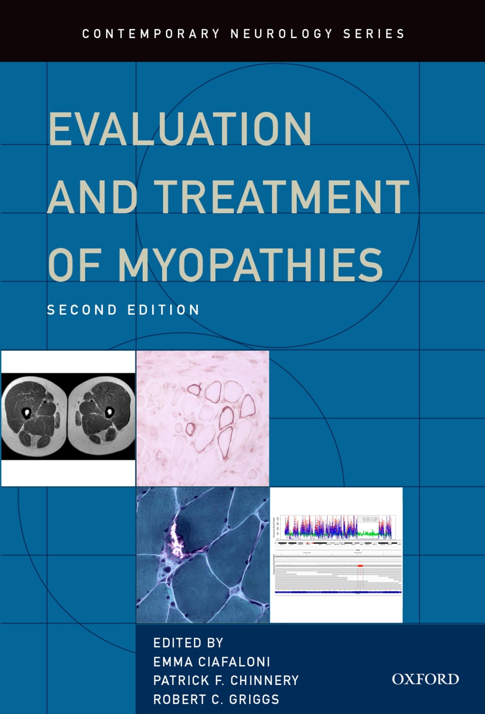 Evaluation and Treatment of Myopathies - Comprehensive Guide to Muscle Disorders | Contemporary Neurology Series | For Doctors, Neurologists & Medical Students