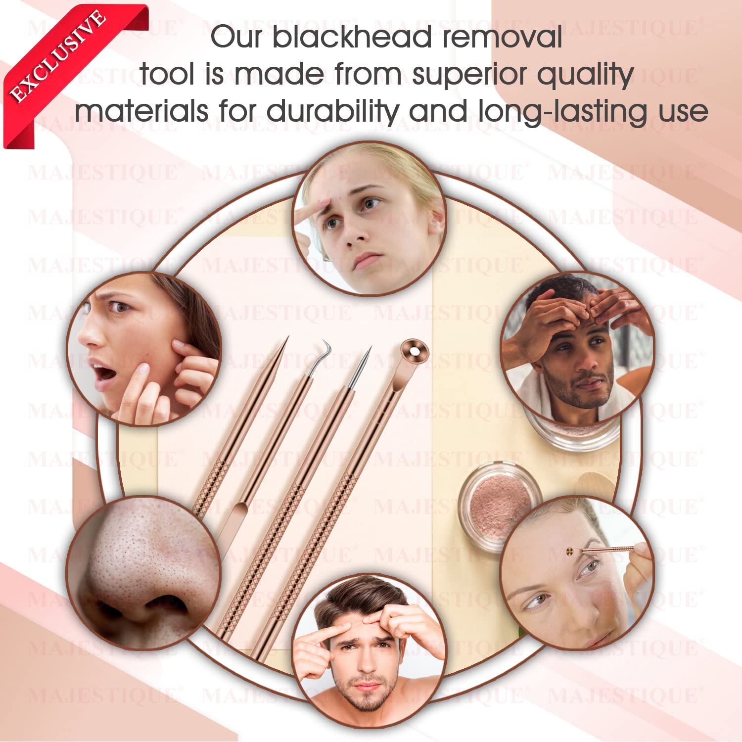 Majestique 4-Piece Blackhead Remover Kit - Stainless Steel Pimple Extractor Tool for Nose & Face - Whitehead & Blackhead Removal for Men & Women - CMB530 - Perfect for Home Skincare & Spa Treatments
