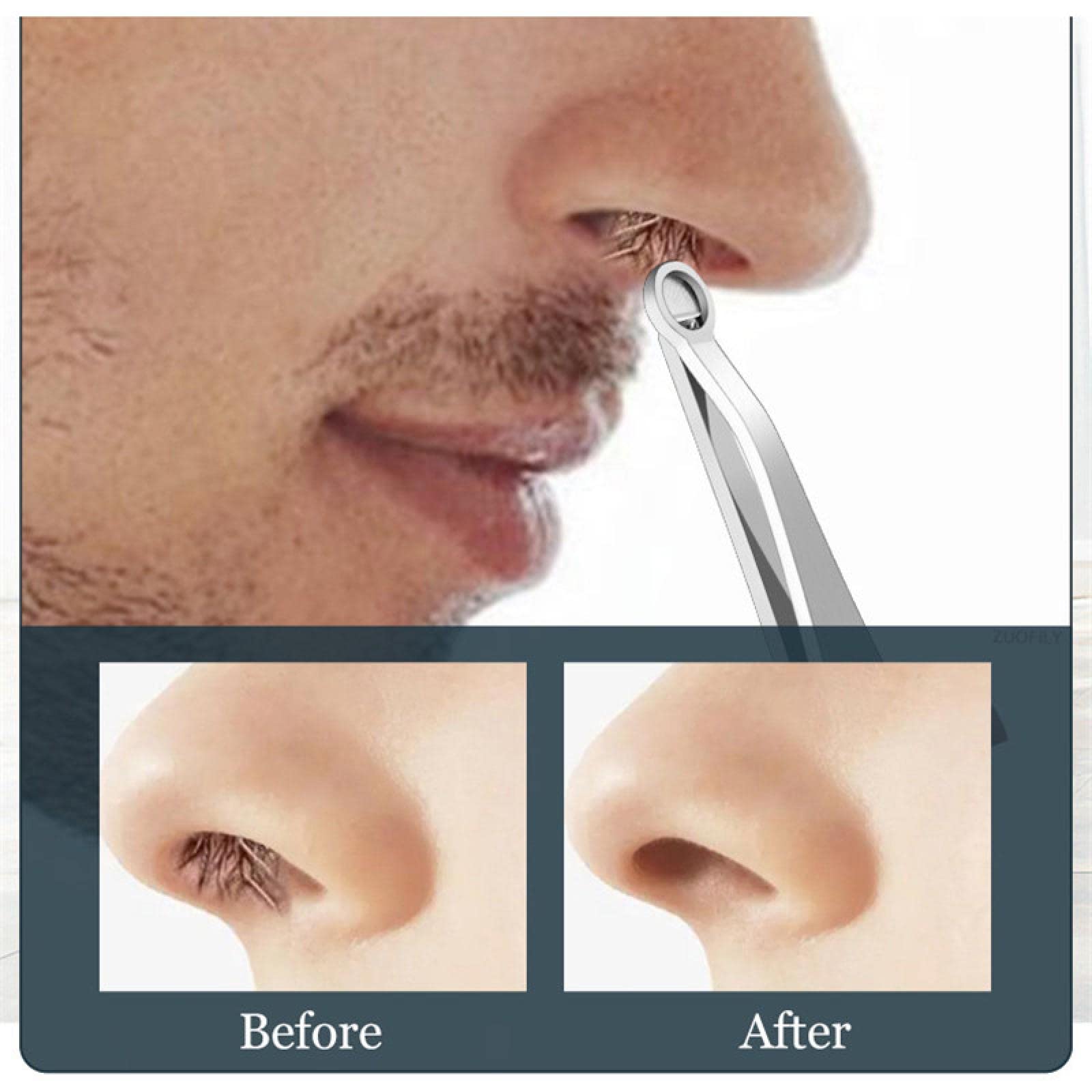AKAZI Men's Stainless Steel Nose & Facial Hair Trimmer - Yellow | Precision Nose Hair, Beard & Hand Hair Trimmer | Perfect for Grooming, Travel & Personal Care