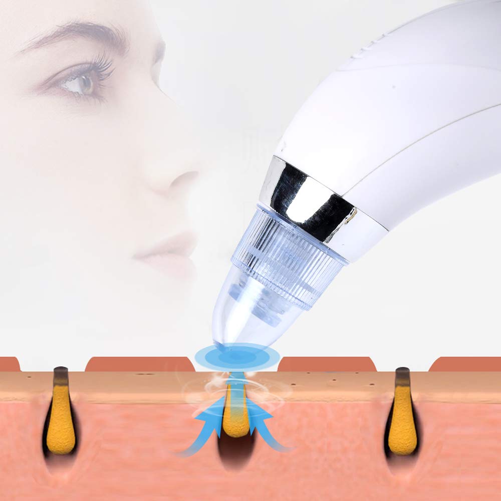 CADITEX Sinophant Blackhead Remover - Electric Pore Vacuum Cleaner for Face, Comedo & Acne Extractor Tool for Women & Men | Perfect for Deep Cleansing & Skincare Routine at Home