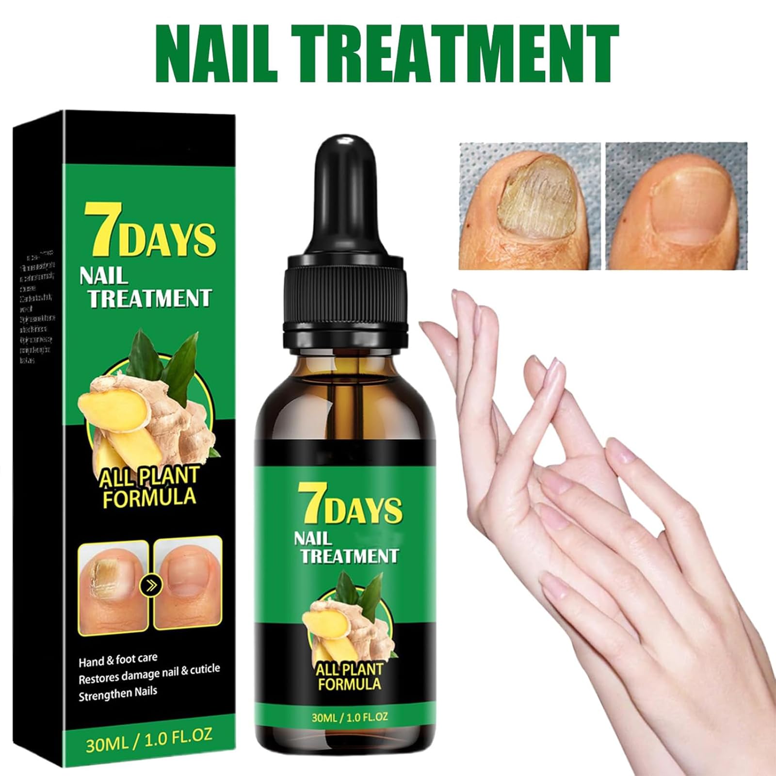 7 DAYS Ginger Foot Spray & Nail Repair Treatment - Strengthening Cuticle Care Oil for Healthy Nails (30ml) - Ideal for Dry Feet, Cracked Heels & Brittle Nails at Home or Salon