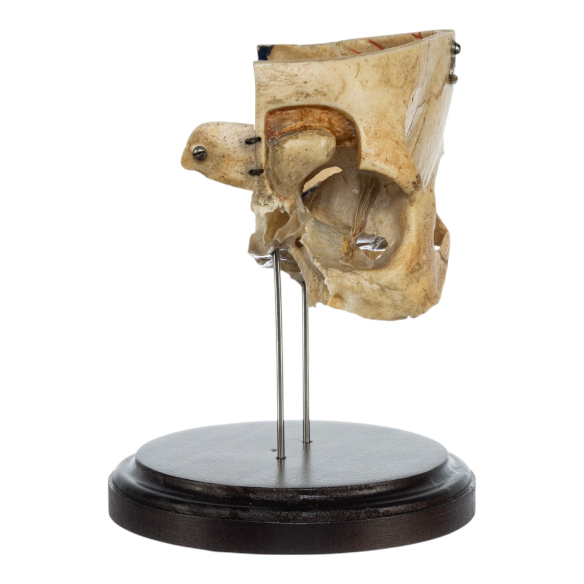 Real Human Partial Skull Replica with Display Stand - Perfect for Anatomy Study, Medical Education & Halloween Decor