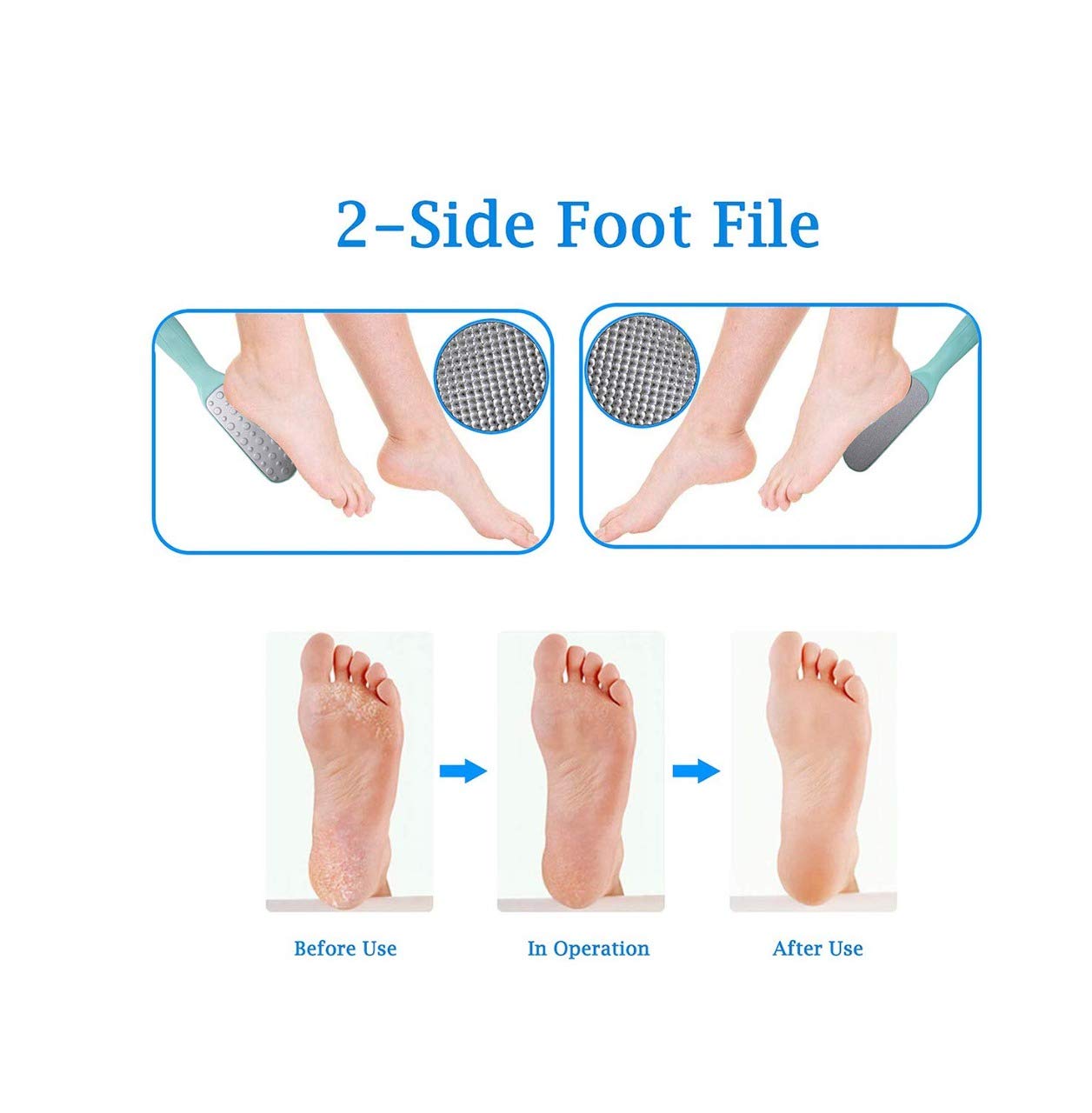 SIYAA Double Sided Metal Foot File - Callus Remover & Dead Skin Scrubber for Soft Feet - Professional Pedicure Tool for Home Spa & Salon Use - Pack of 1