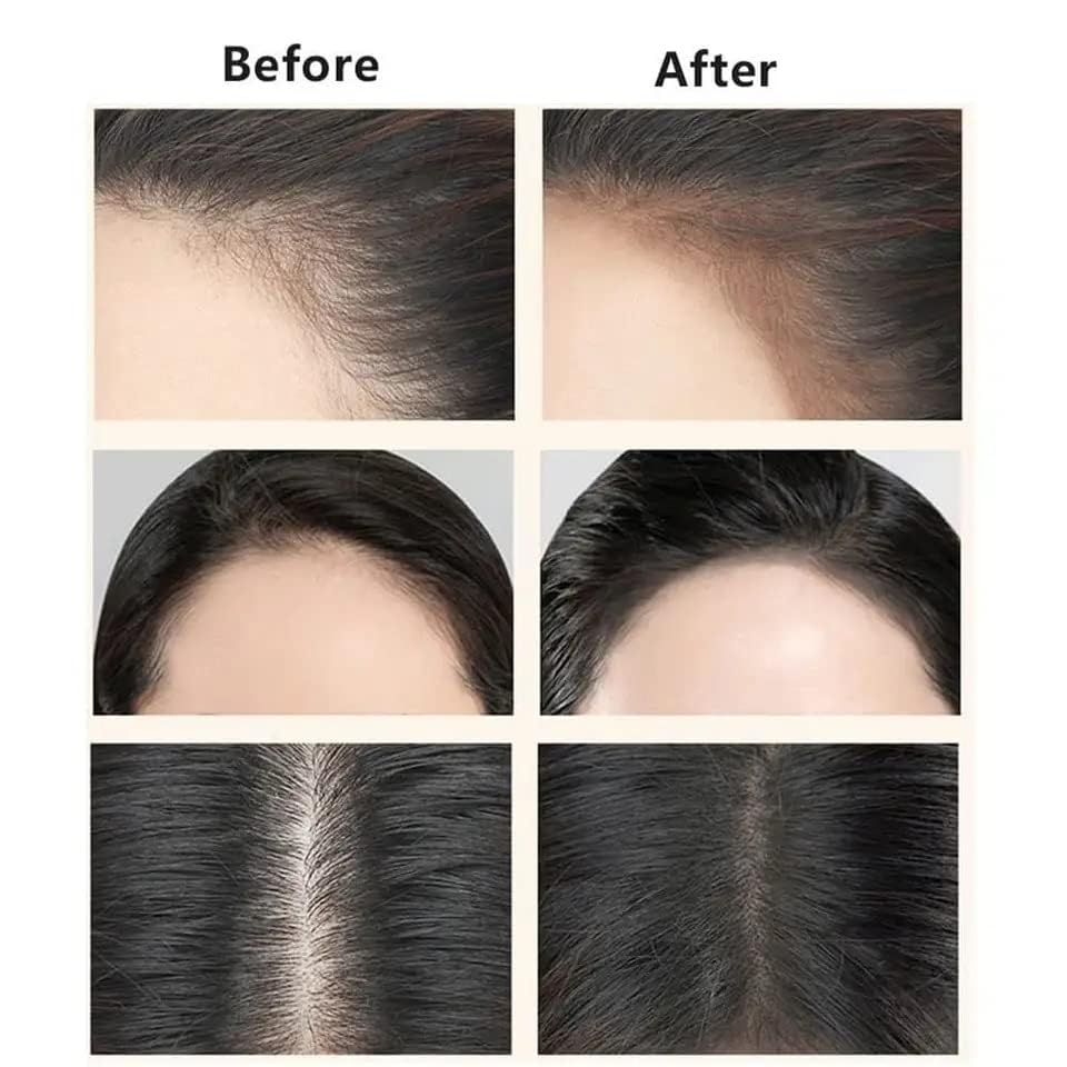 GREEVA Hair Shadow Powder & Hairline Powder Stick - Instant Root Touch-Up for Thinning Hair, Balding & Hair Loss - Quick Cover Hair Fall Concealer (Black) - Perfect for Daily Use, Travel & Special Occasions