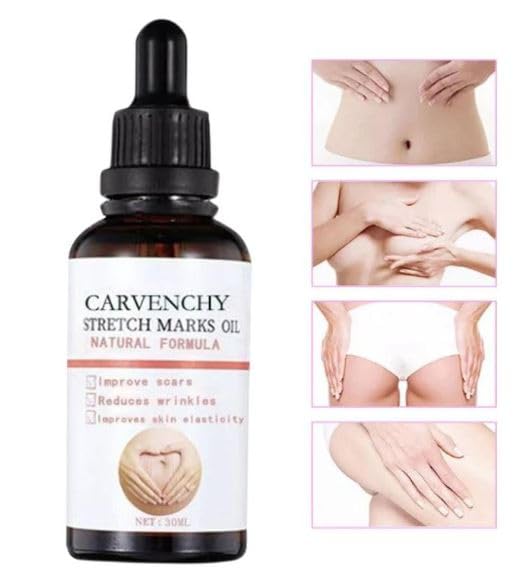 Ramley Stretch Marks Oil for Women - 30ML | Pregnancy Safe, Deep Moisturizing & Skin Repair for Radiant Look | Perfect for Pre & Postpartum Care, Daily Hydration & Stretch Mark Prevention