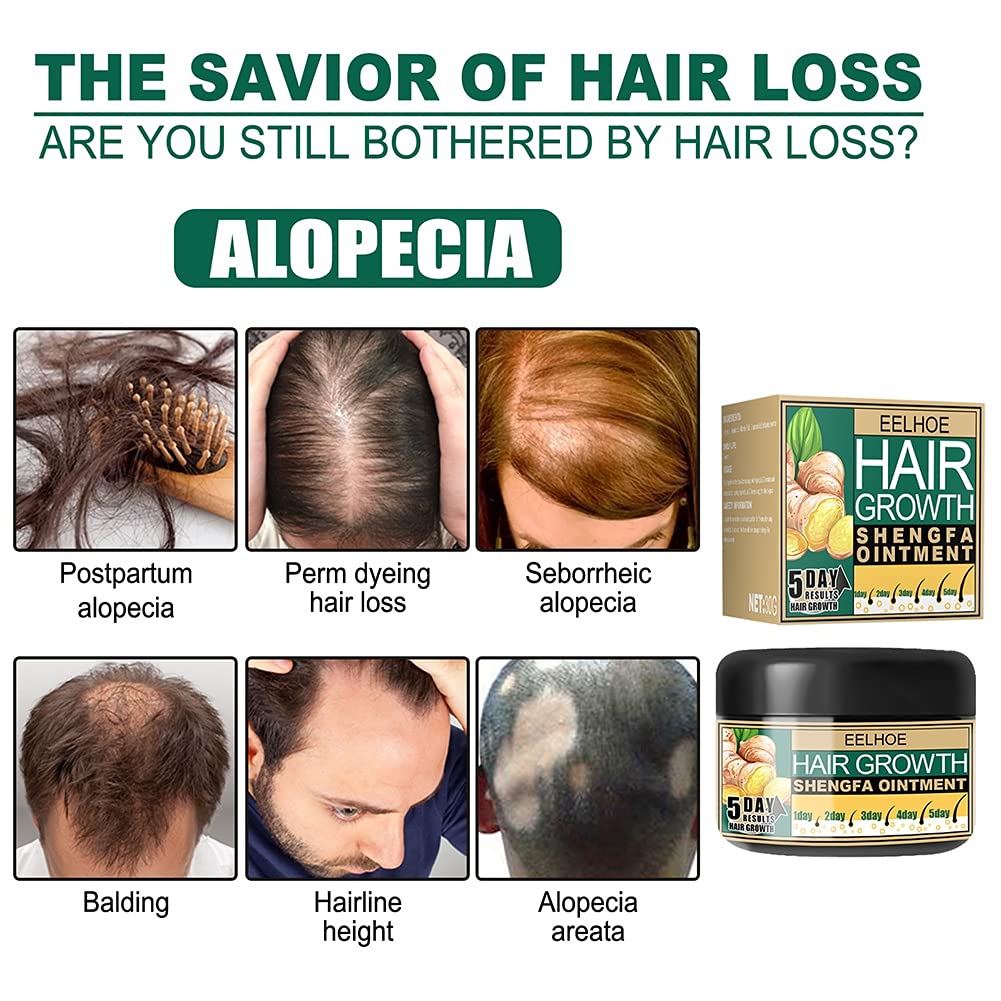 Hair Growth Cream for Bald Spot Treatment - Scalp Moisturizer & Follicle Conditioner for Men & Women - Promotes Hair Regrowth & Scalp Massage - Ideal for Thinning Hair & Daily Hair Care Routine