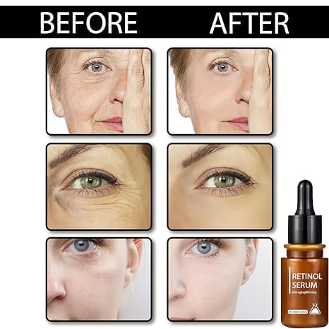 Biophotonix Retinol Anti-Aging Serum for Face - Hydrating & Moisturizing Treatment to Reduce Fine Lines & Wrinkles, Clock-Back Skincare Solution (2 Pack) - Perfect for Night Routine & Mature Skin Care Regimen