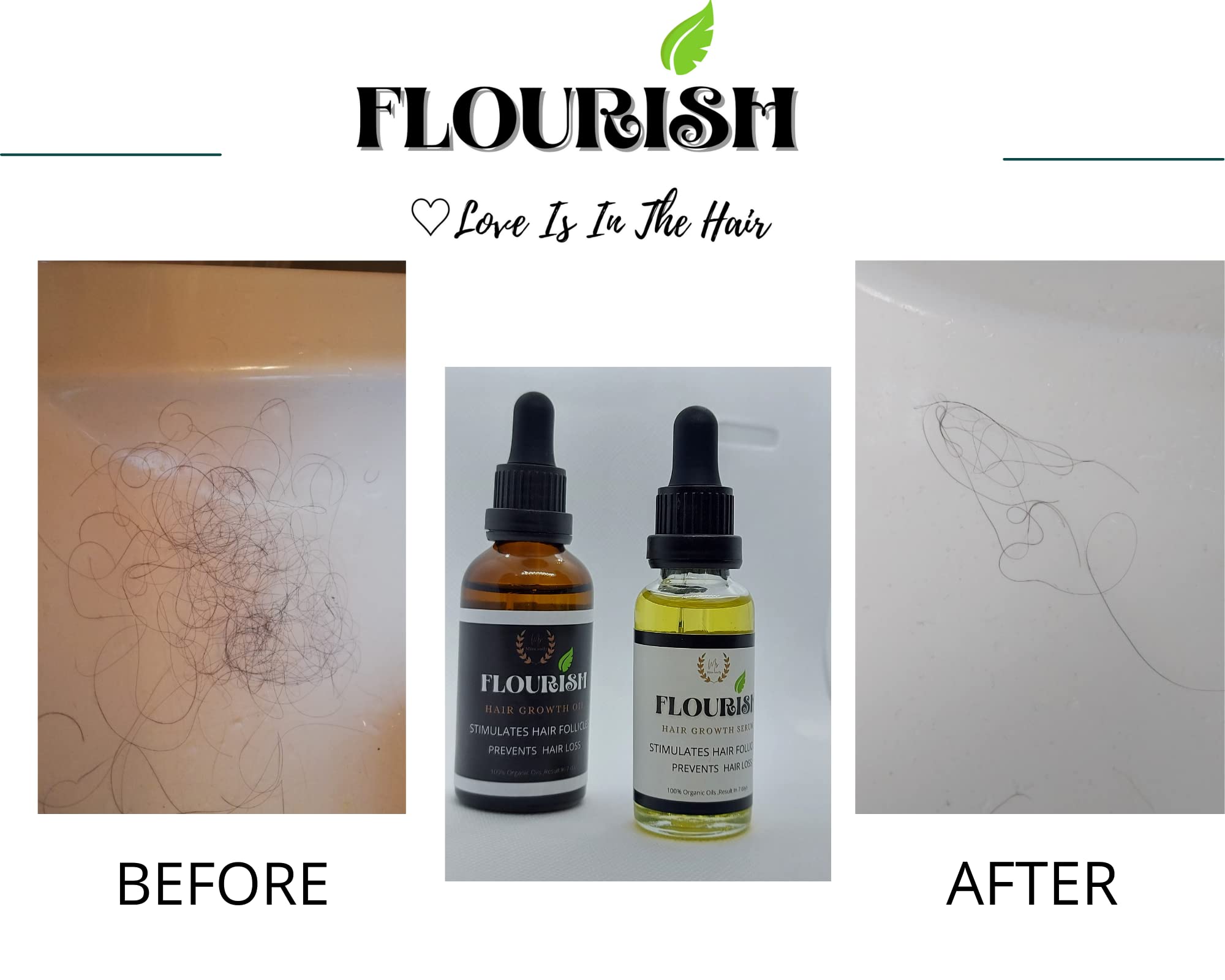 FLOURIS Hair Growth Oil - Natural Scalp Treatment for Thicker, Longer Hair | Best for Hair Loss Prevention & Healthy Hair Care
