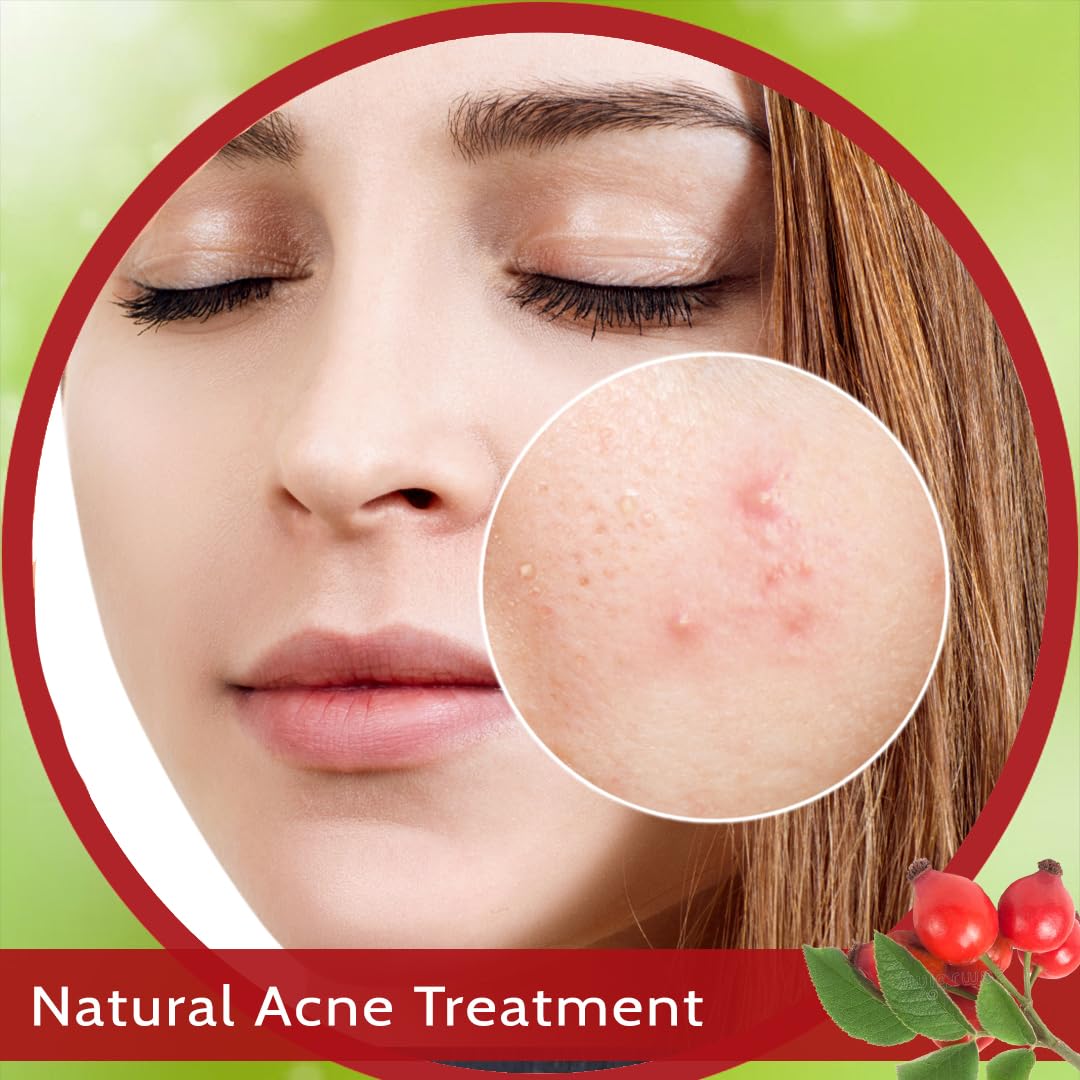 **Seyal 100% Pure Cold Pressed Rosehip Seed Oil for Face - Natural Therapeutic Grade Facial Oil for Glowing Skin, Reduces Scars & Stretch Marks - 15ml | Perfect for Night Routine, Dry Skin & Anti-Aging Care**