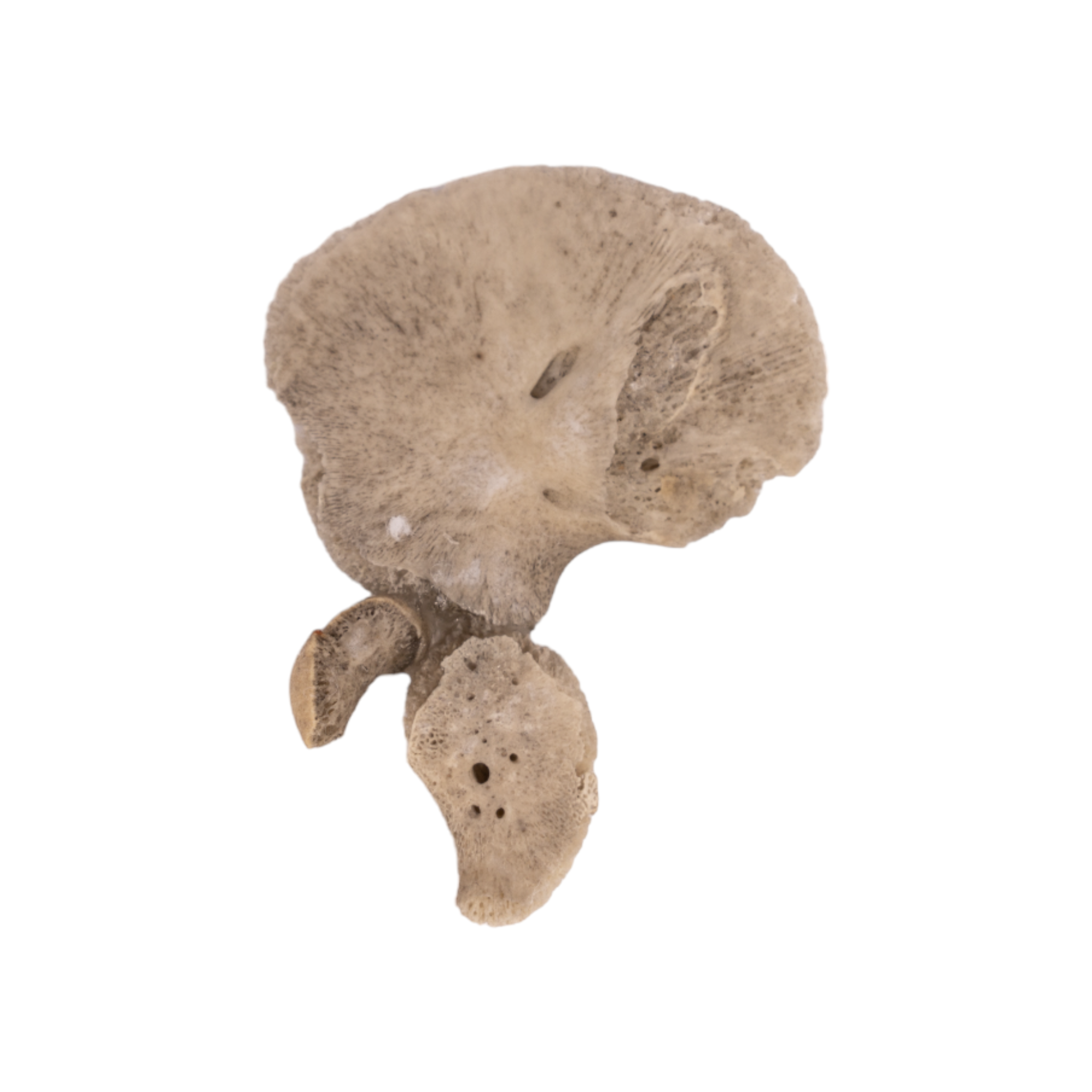 Premium Human Fetal Ilium for Medical Research - High-Quality Anatomical Specimen for Pathology Studies, Medical Education & Scientific Research