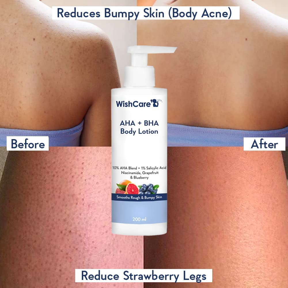 Glycolic & Lactic Acid Body Lotion with Niacinamide for Smooth Skin - 6.76 Fl Oz - Hydrating Moisturizer for Dry, Rough & Bumpy Skin - Perfect for Daily Use & Post-Shaving Care
