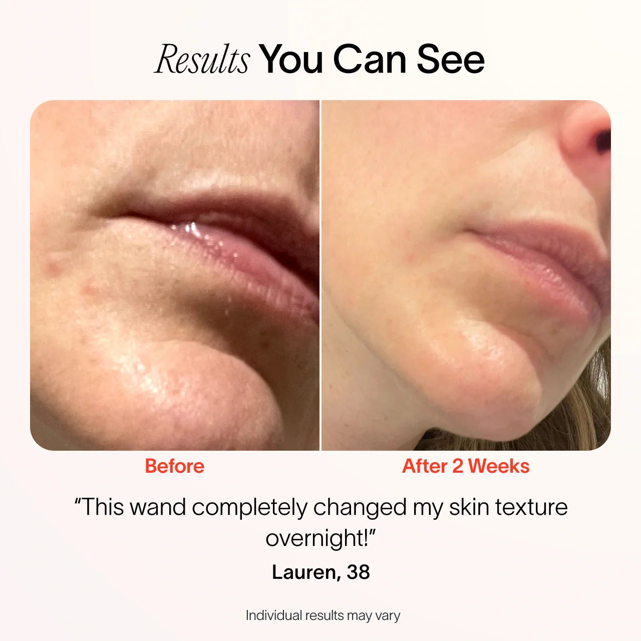 4 in 1 Radiant Renewal Skincare Wand with Red Light Therapy - Anti-Aging, Wrinkle Reduction & Skin Rejuvenation | At-Home Facial Treatment Device for Glowing Skin | Perfect for Daily Skincare Routine & Spa Nights