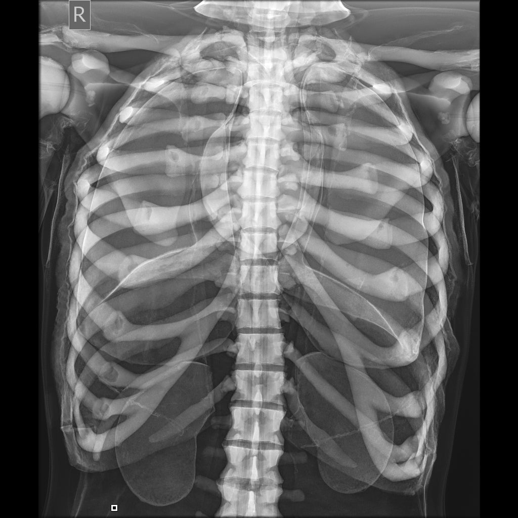 Full Body X-Ray and Radiographic Positioning Manikin - Professional Medical Training Model for Radiology Students & Technicians - Perfect for Classroom, Lab & Clinical Practice