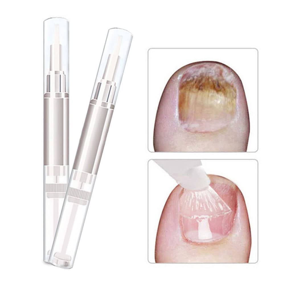 Allbestaye Fungal Nail Repair Pen - Effective Treatment for Onychomycosis & Paronychia, Restores Healthy Nails Damaged by Fungus | Anti-Fungal Nail Infection Solution for Toenails & Fingernails | Perfect for Daily Nail Care & Salon Use