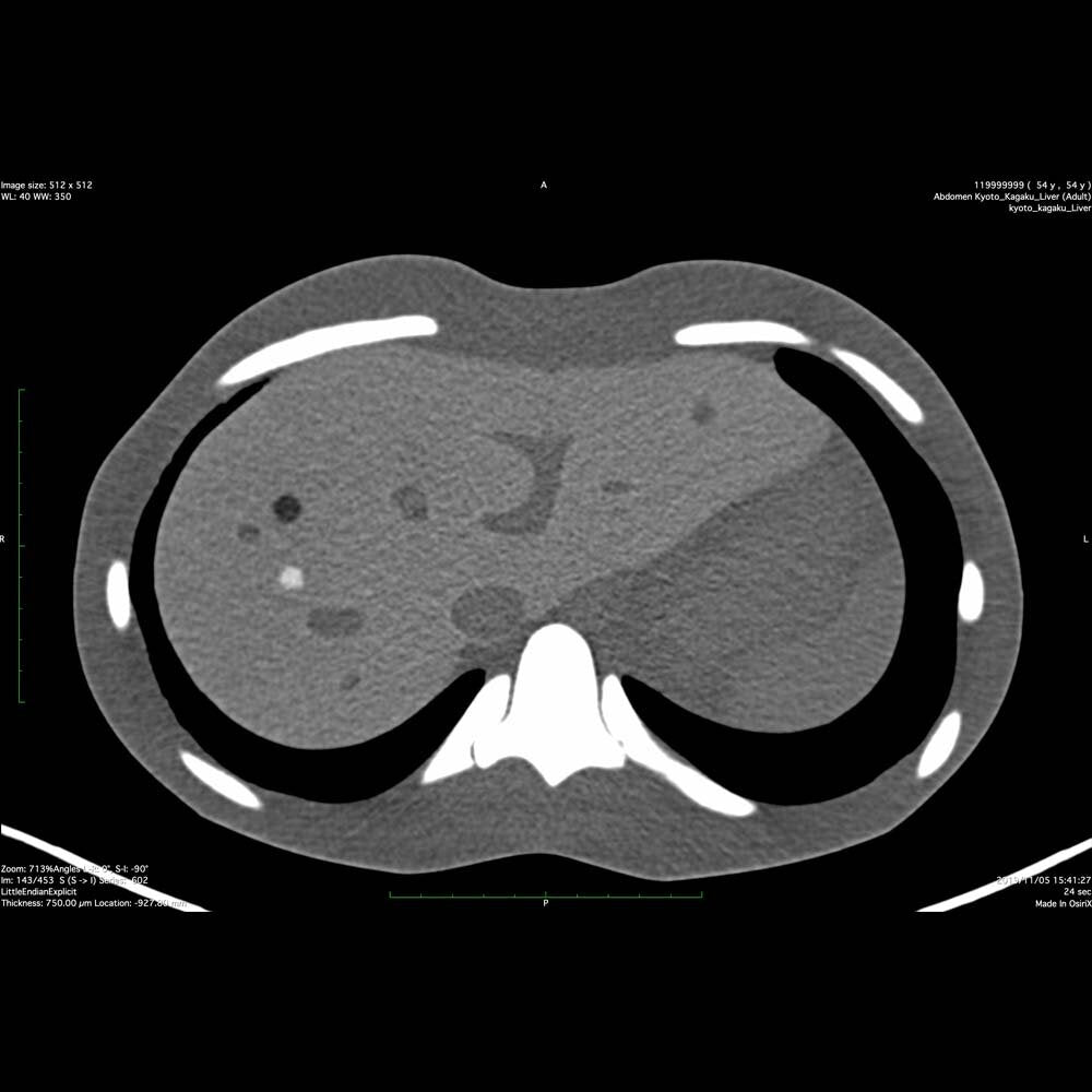 Dual Modality Human Abdomen Phantom for CT and Ultrasound Imaging - Ideal for Medical Training, Diagnostic Practice, and Radiology Research