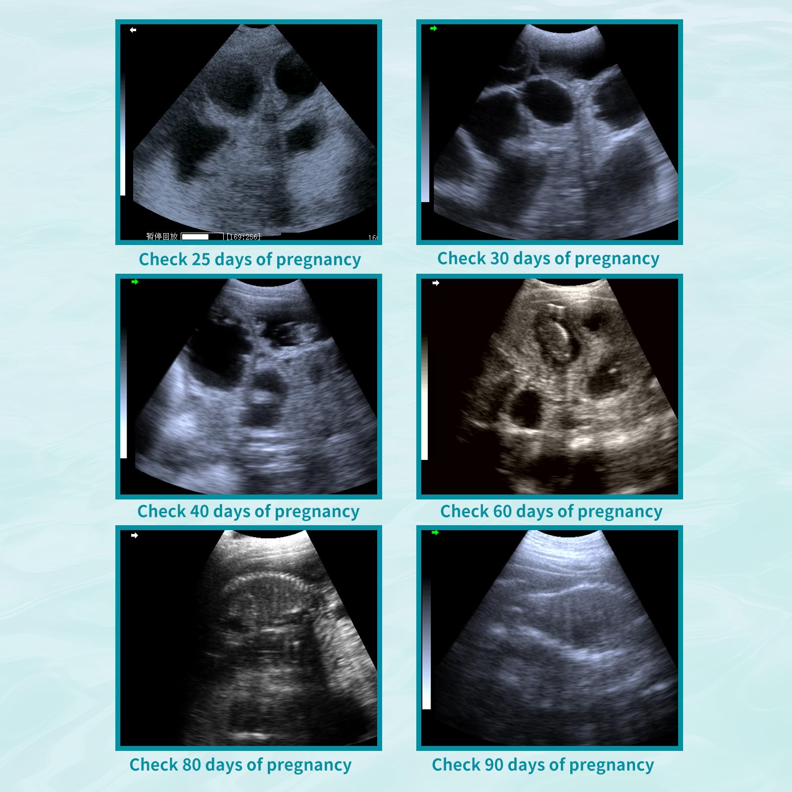 Portable Dog Ultrasound Machine for Pregnancy - 3.5MHz Convex Probe for At-Home Pet Pregnancy Testing in Dogs, Cats, Sheep, Goats & Pigs | Ideal for Veterinarians, Breeders & Farmers