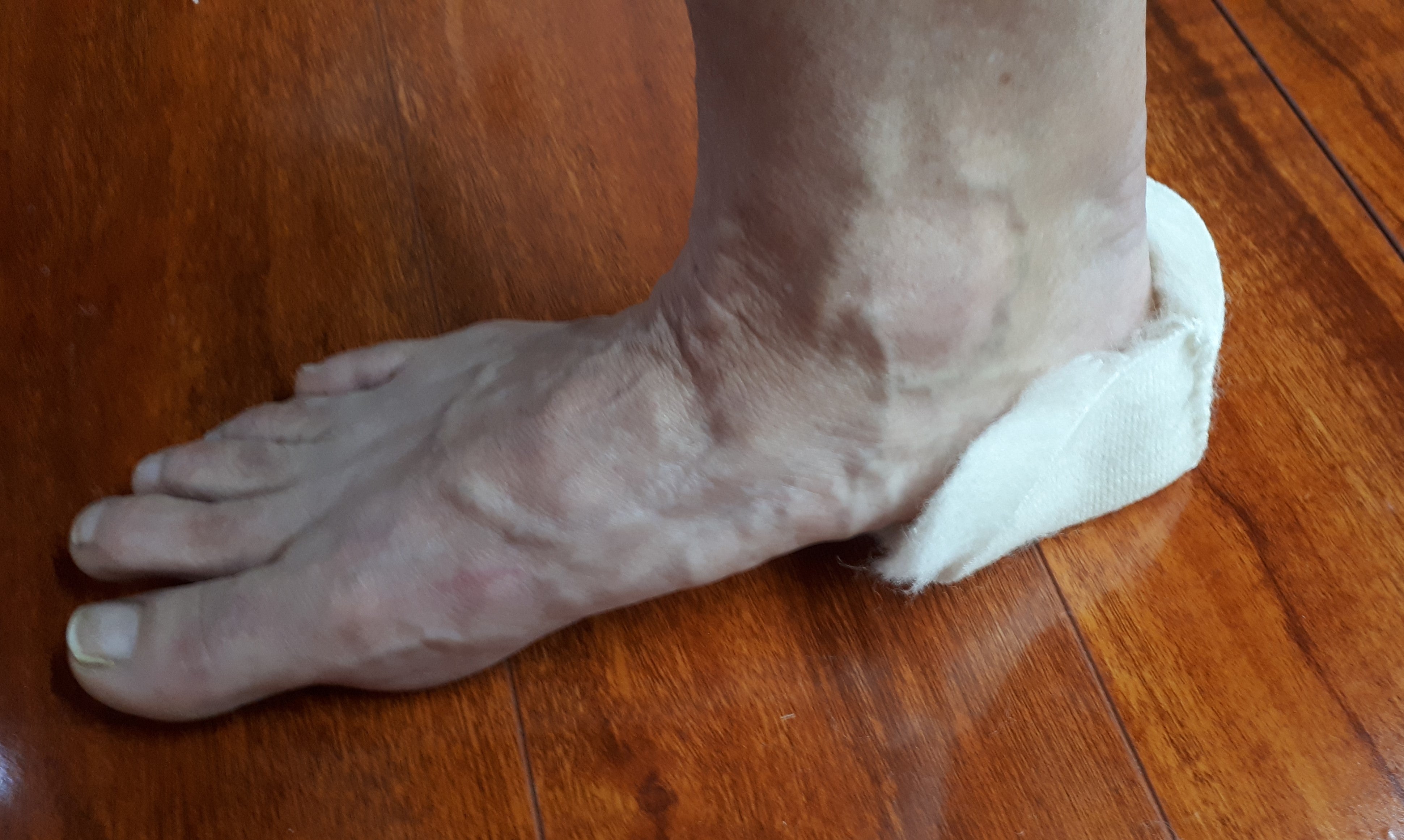 Premium Wound Care Heel Cuff Pads - Soft & Breathable Heel Protectors for Bedridden Patients & Diabetic Foot Care - Ideal for Pressure Ulcer Prevention & Post-Surgery Recovery