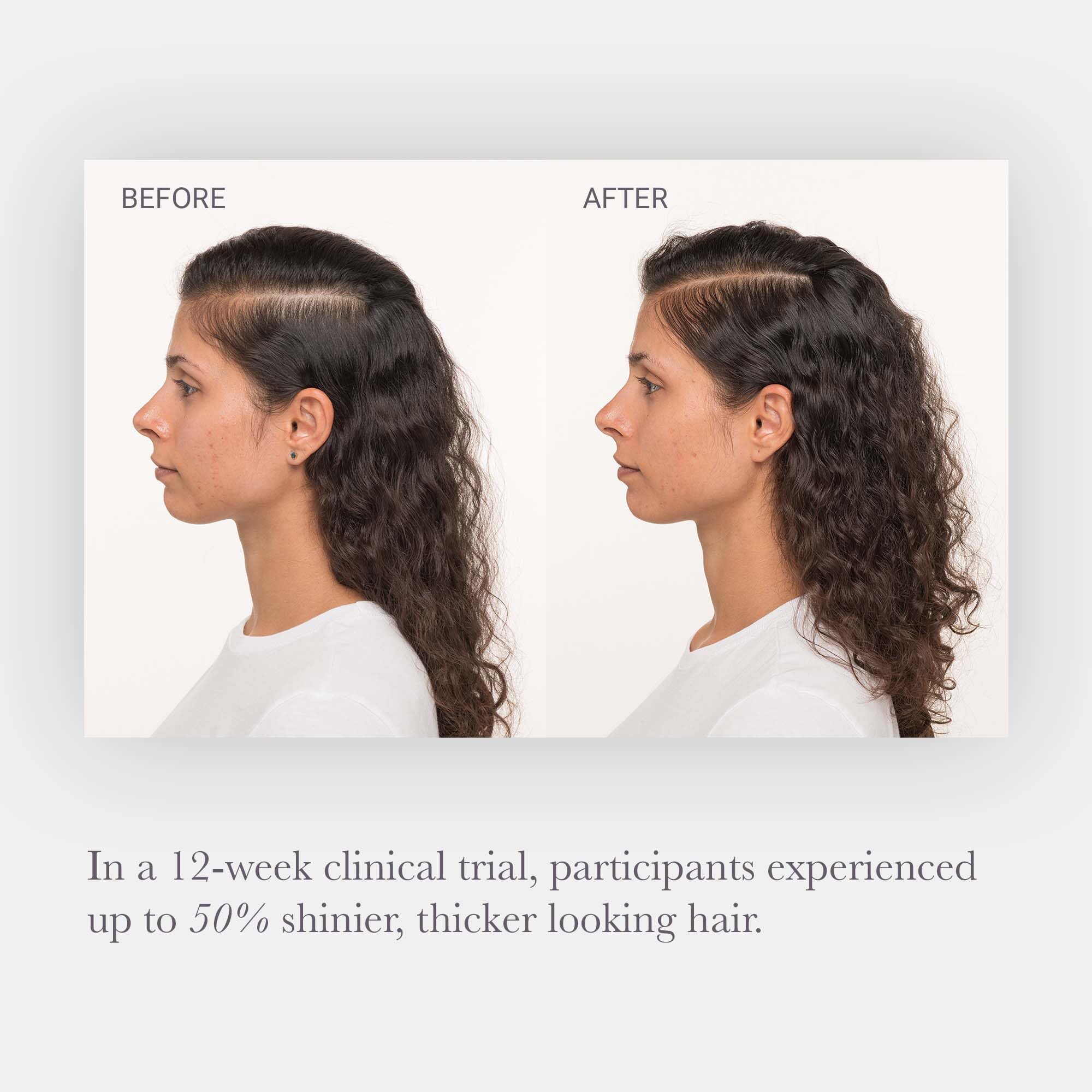 NULASTIN Hair Serum for Thinning Hair - Keratin & Peptides Scalp Treatment to Reduce Shedding & Boost Volume - 2 Pack (1.7 Oz Each) - Ideal for Daily Hair Care & Thicker Looking Hair Growth