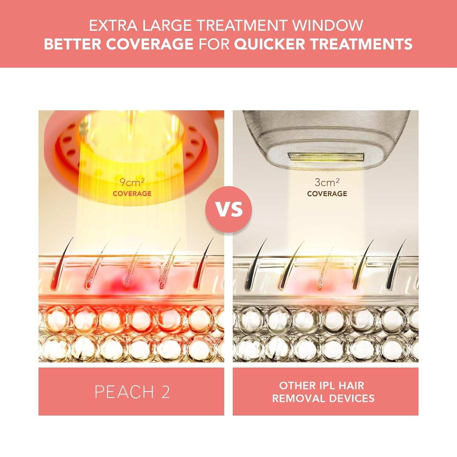 FOREO PEACH 2 IPL Hair Removal Device for Women & Men - Permanent Hair Reduction for Face, Legs, Underarms & Bikini Line - At-Home Laser Hair Removal Treatment with Smooth Skin Technology